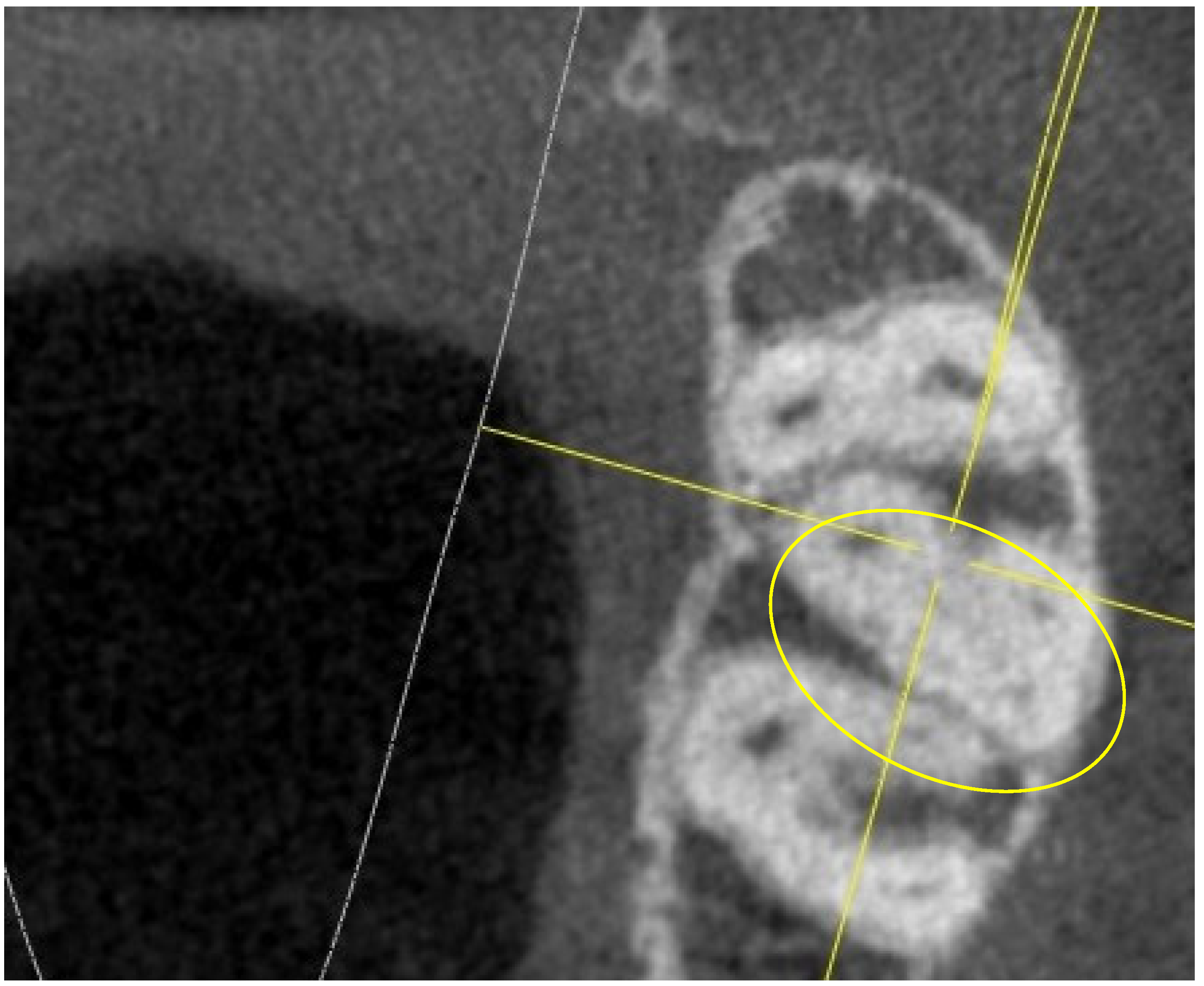 Jimaging 10 00009 g008