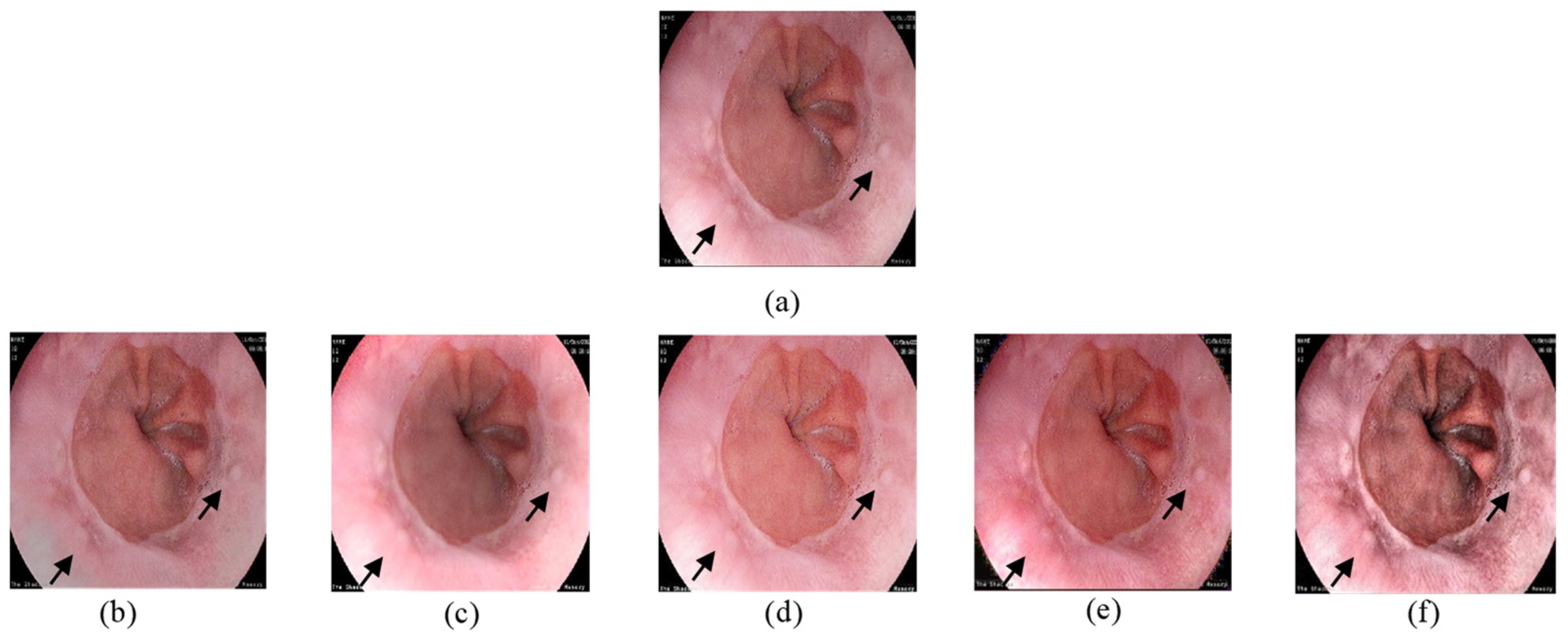 Jimaging 10 00028 g006
