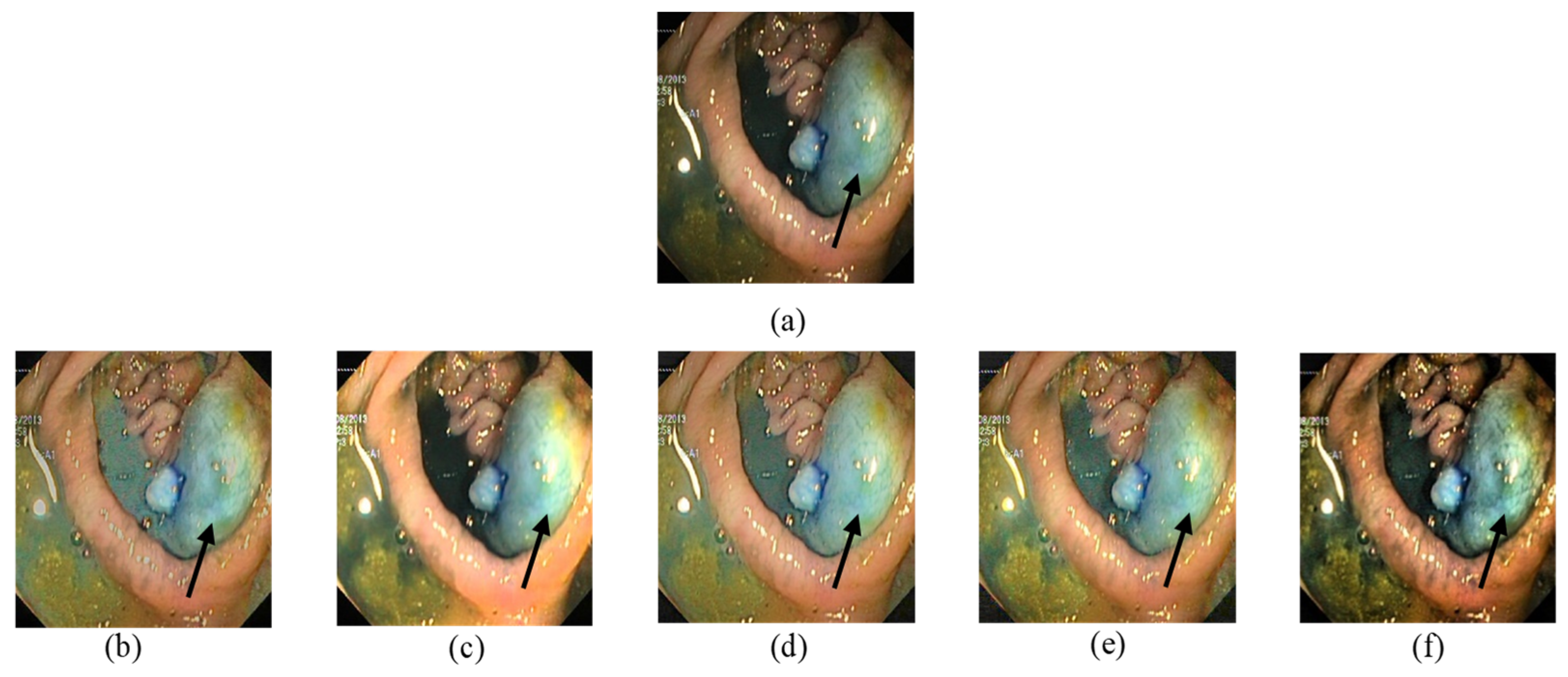 Jimaging 10 00028 g008