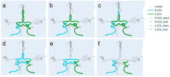 An Improved Path-Finding Method for the Tracking of Centerlines of ...