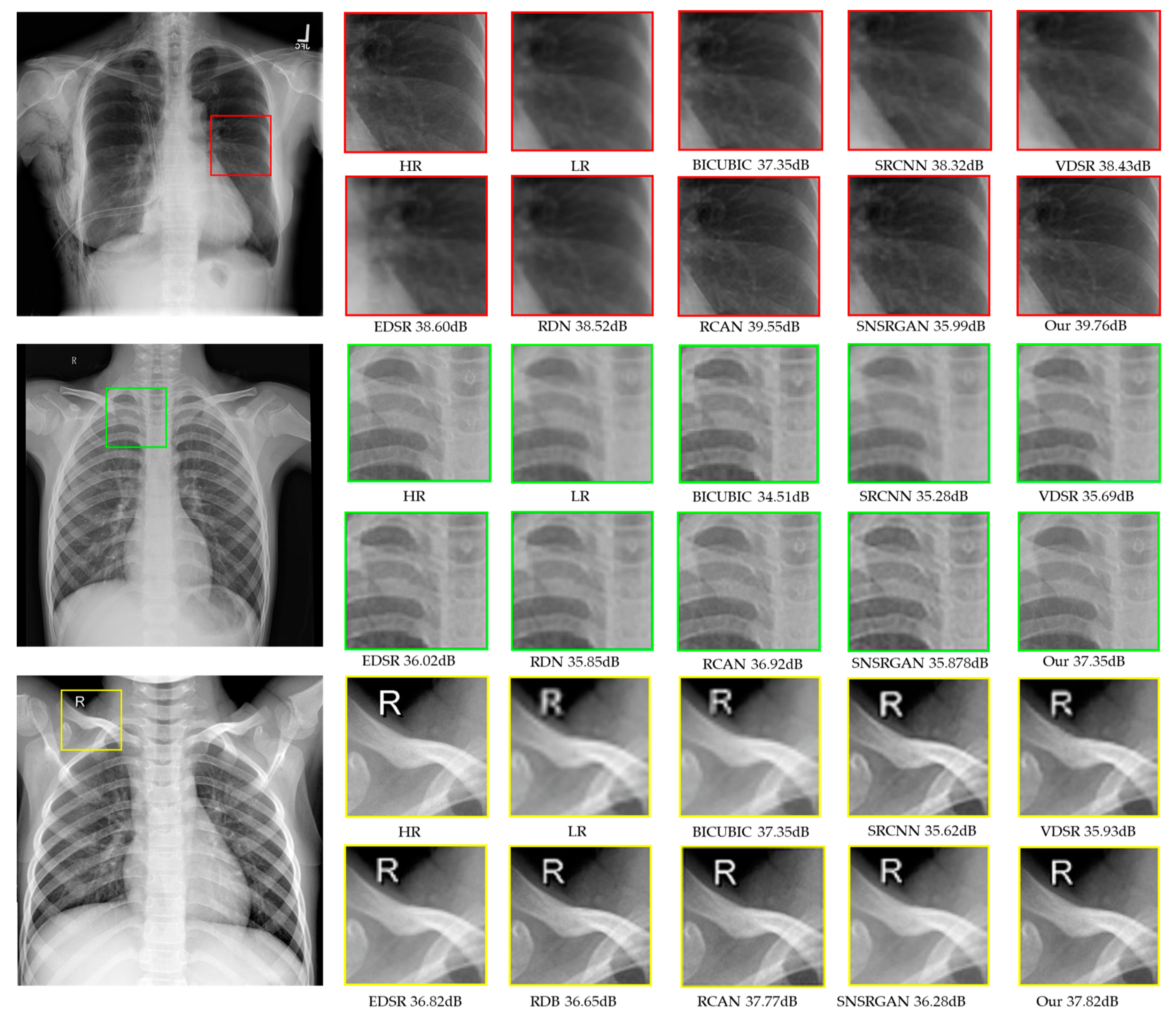 Jimaging 10 00064 g004