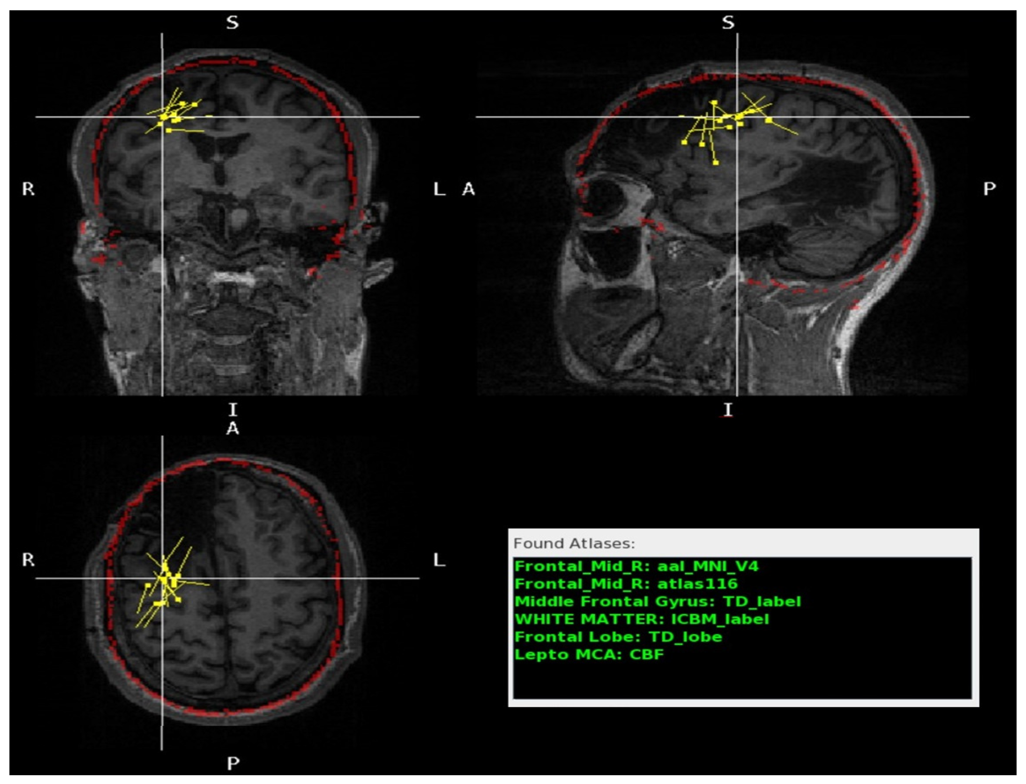 Jimaging 10 00080 g005