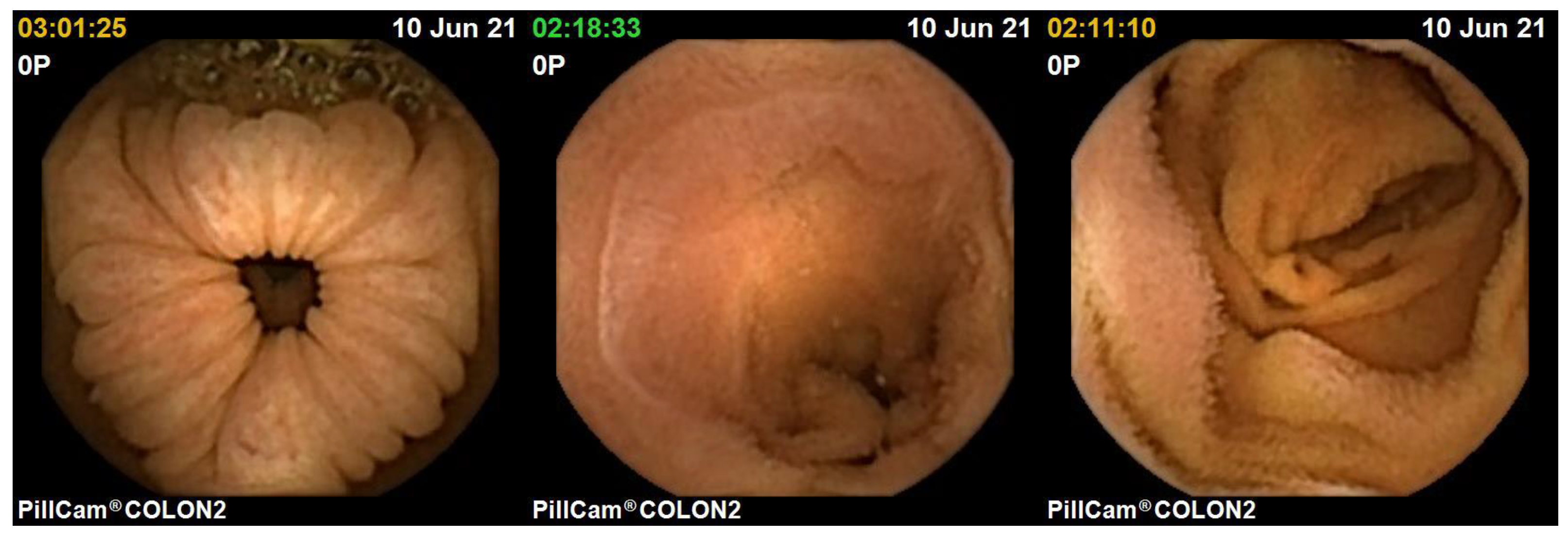Jimaging 10 00082 g014