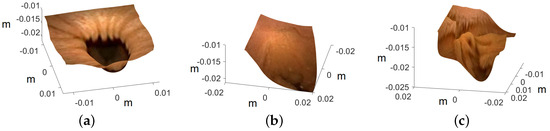 Single-Image-Based 3D Reconstruction of Endoscopic Images