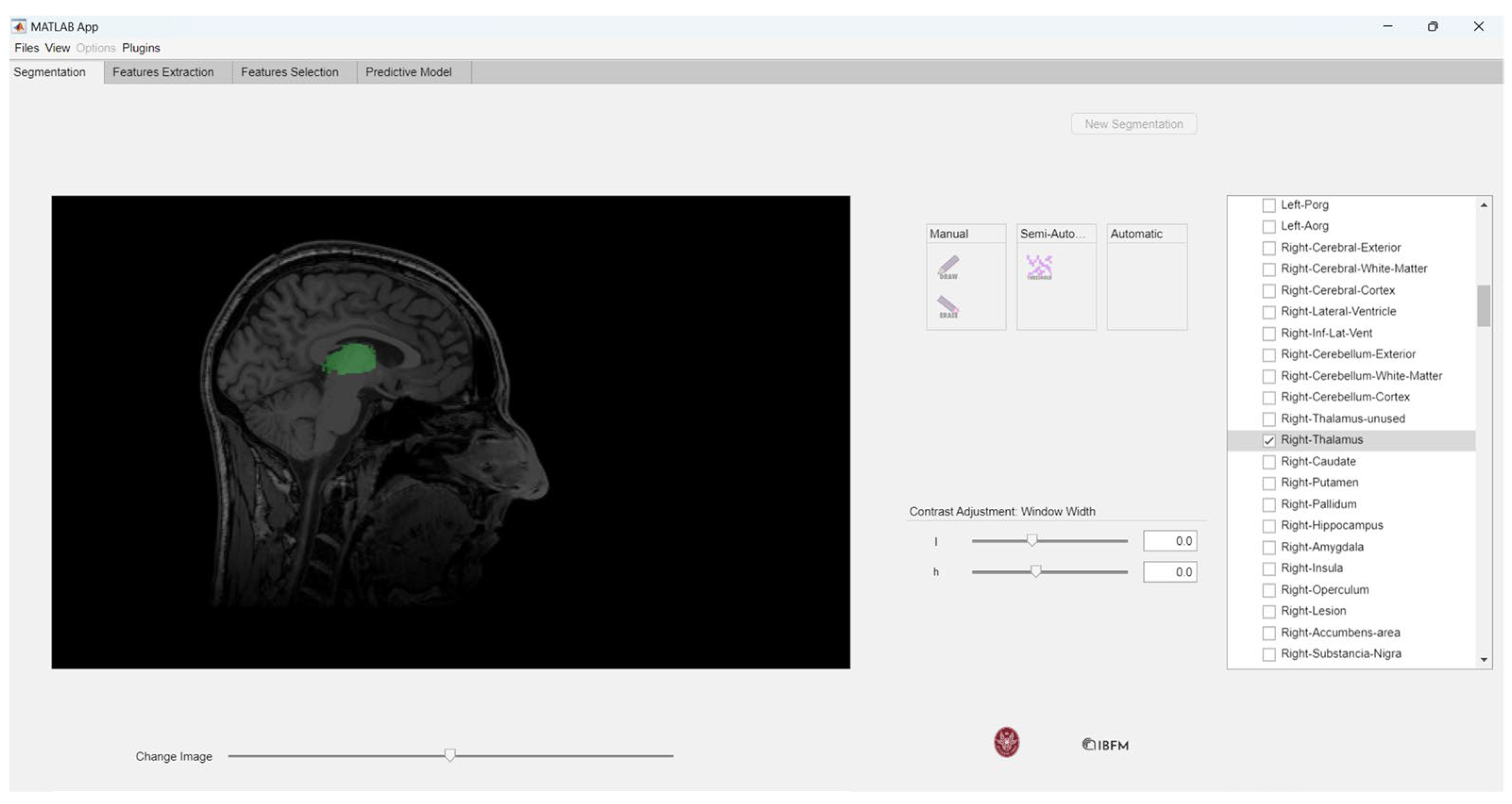 Jimaging 10 00096 g006