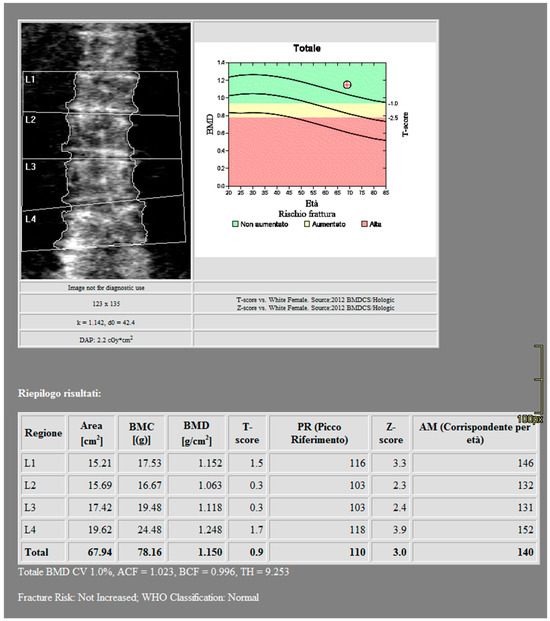 Vertebral and Femoral Bone Mineral Density (BMD) Assessment