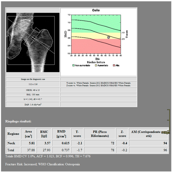 健康・医学 TBR MATERIA MEDICA+ Peripheral DXA Bone Mineral Density Screening Device Now FDA