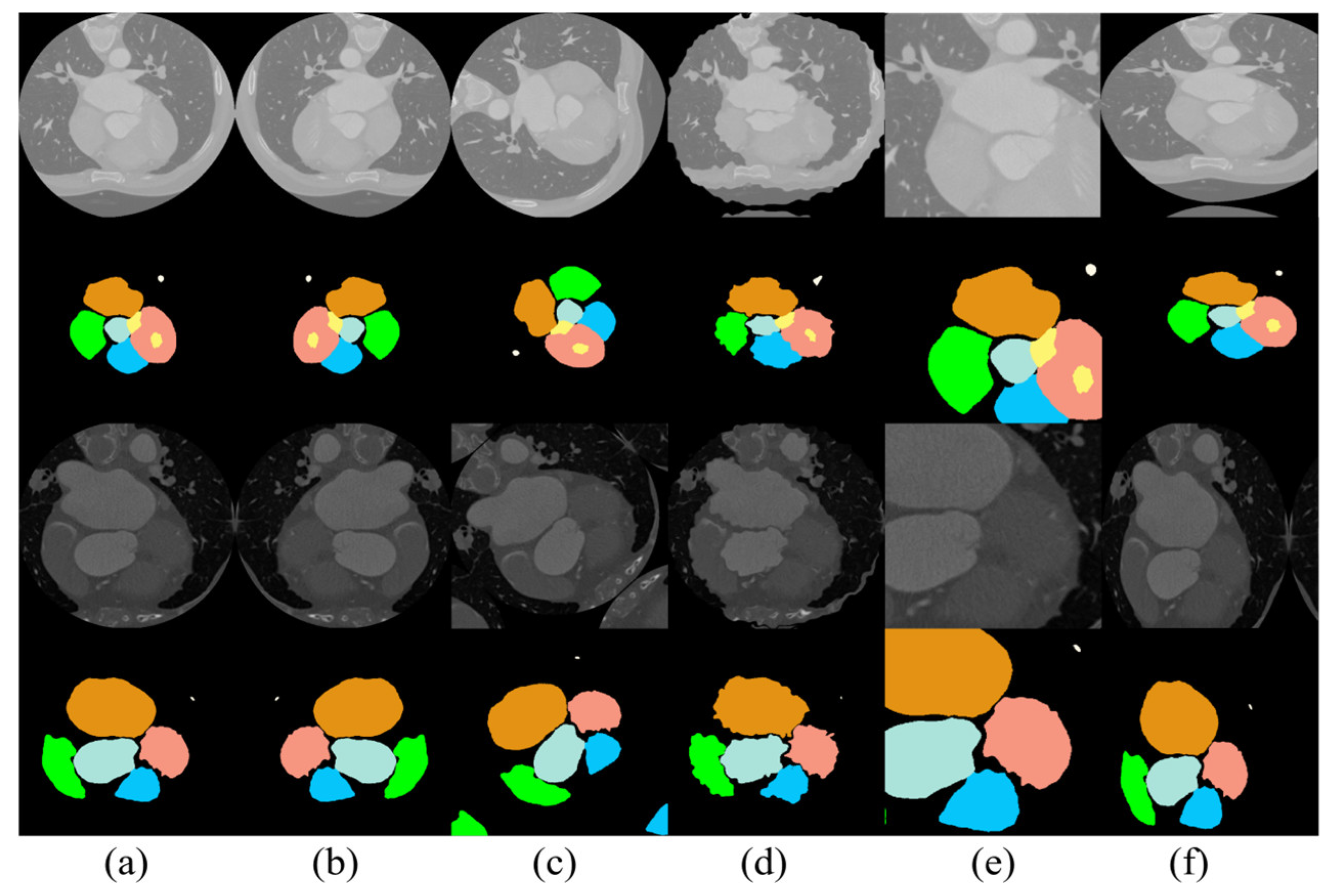Jimaging 10 00135 g005