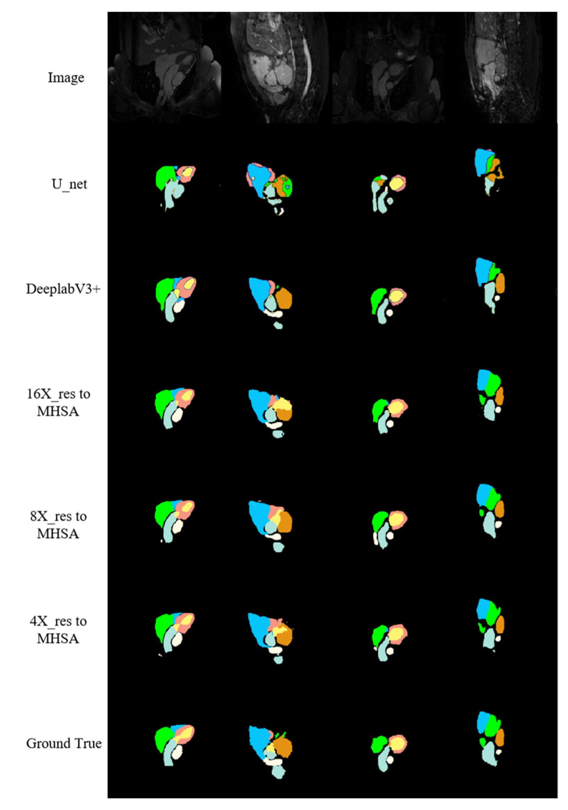 Jimaging 10 00135 g010