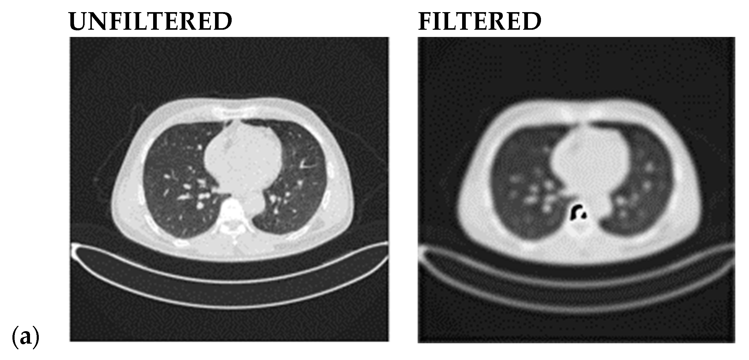 Jimaging 10 00168 g002a