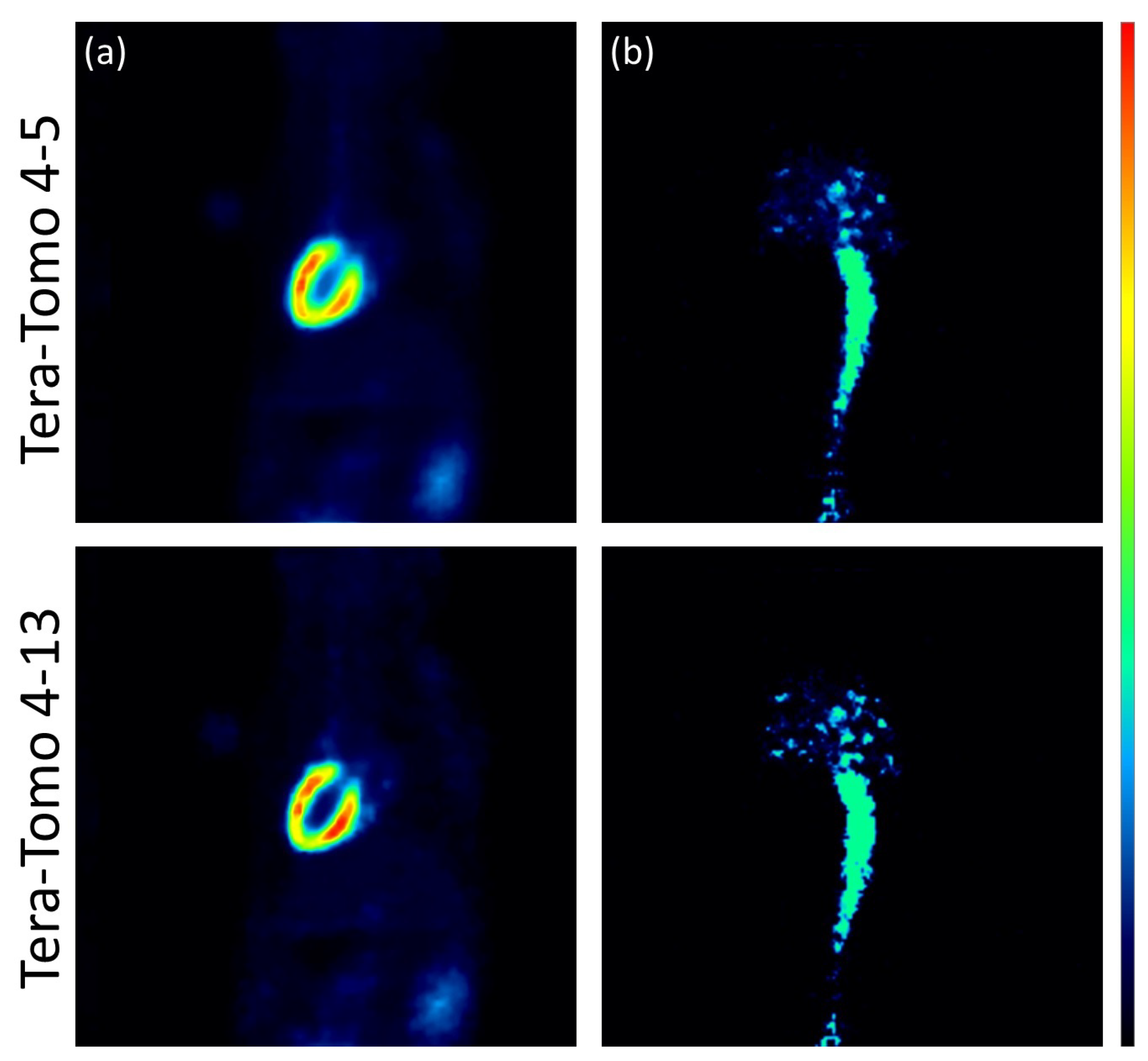 Jimaging 10 00170 g004