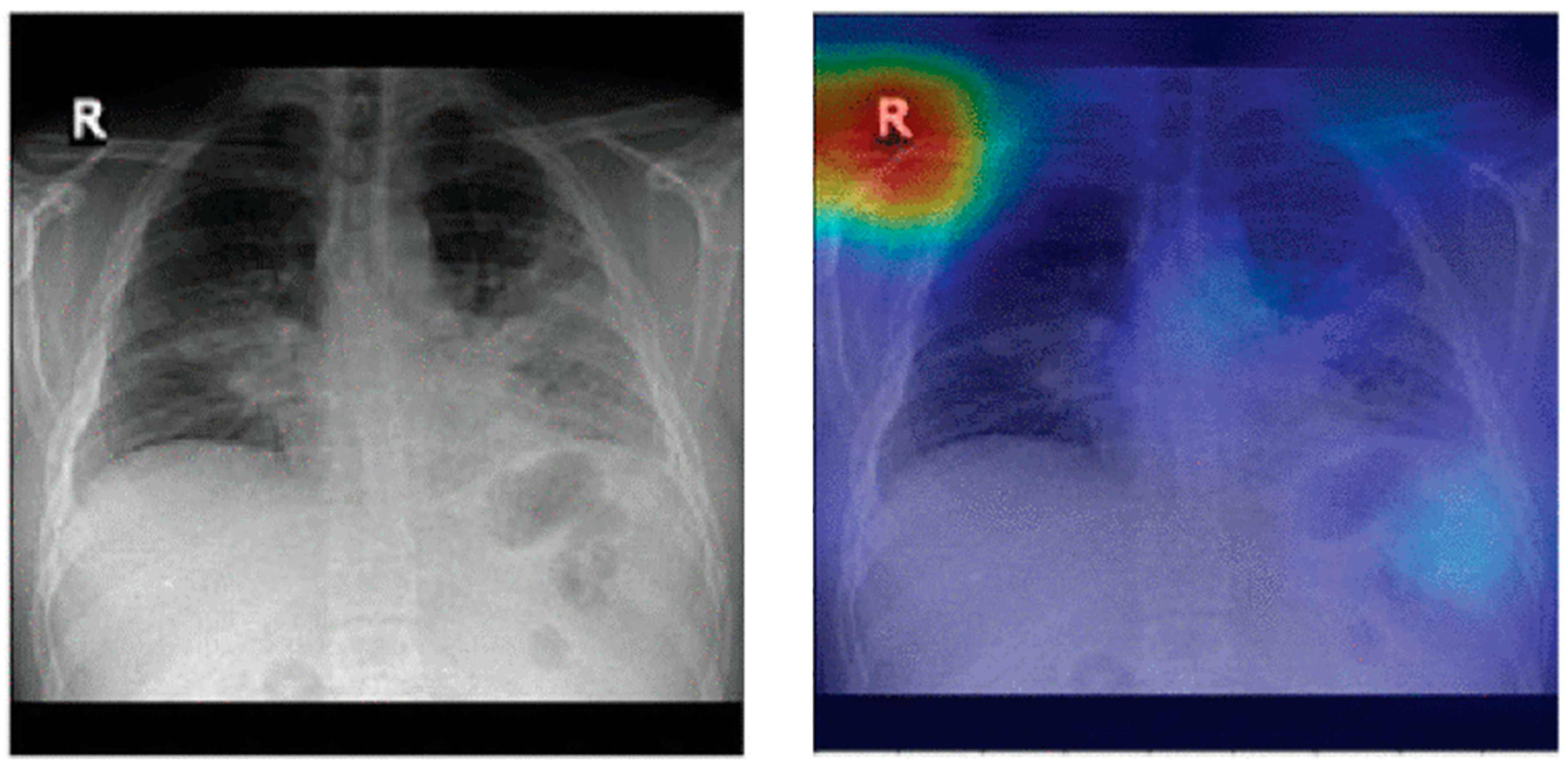 Jimaging 10 00176 g012a