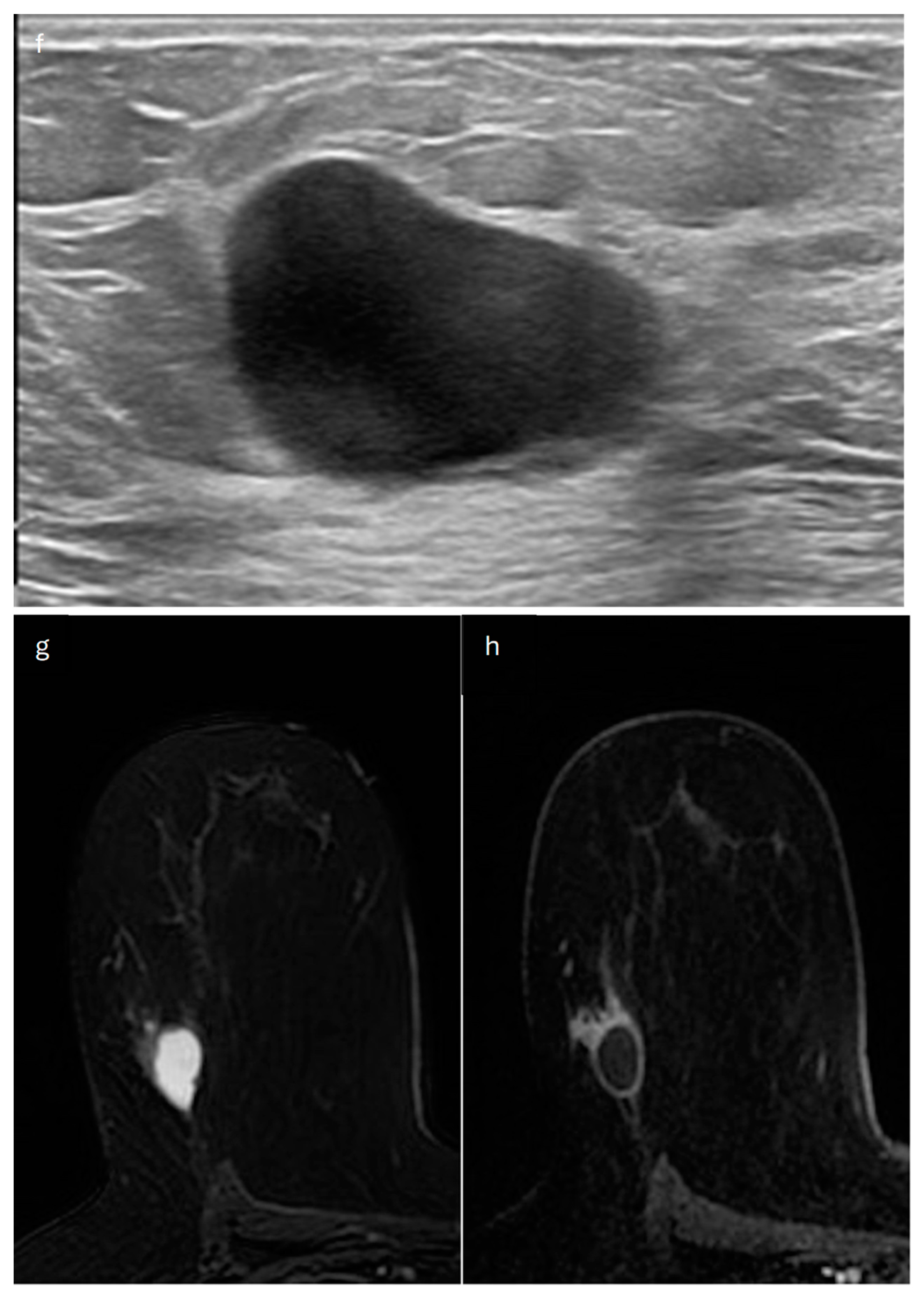 Jimaging 10 00182 g015b