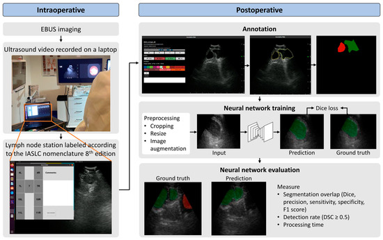 J. Imaging | Free Full-Text | Automatic Segmentation of Mediastinal ...