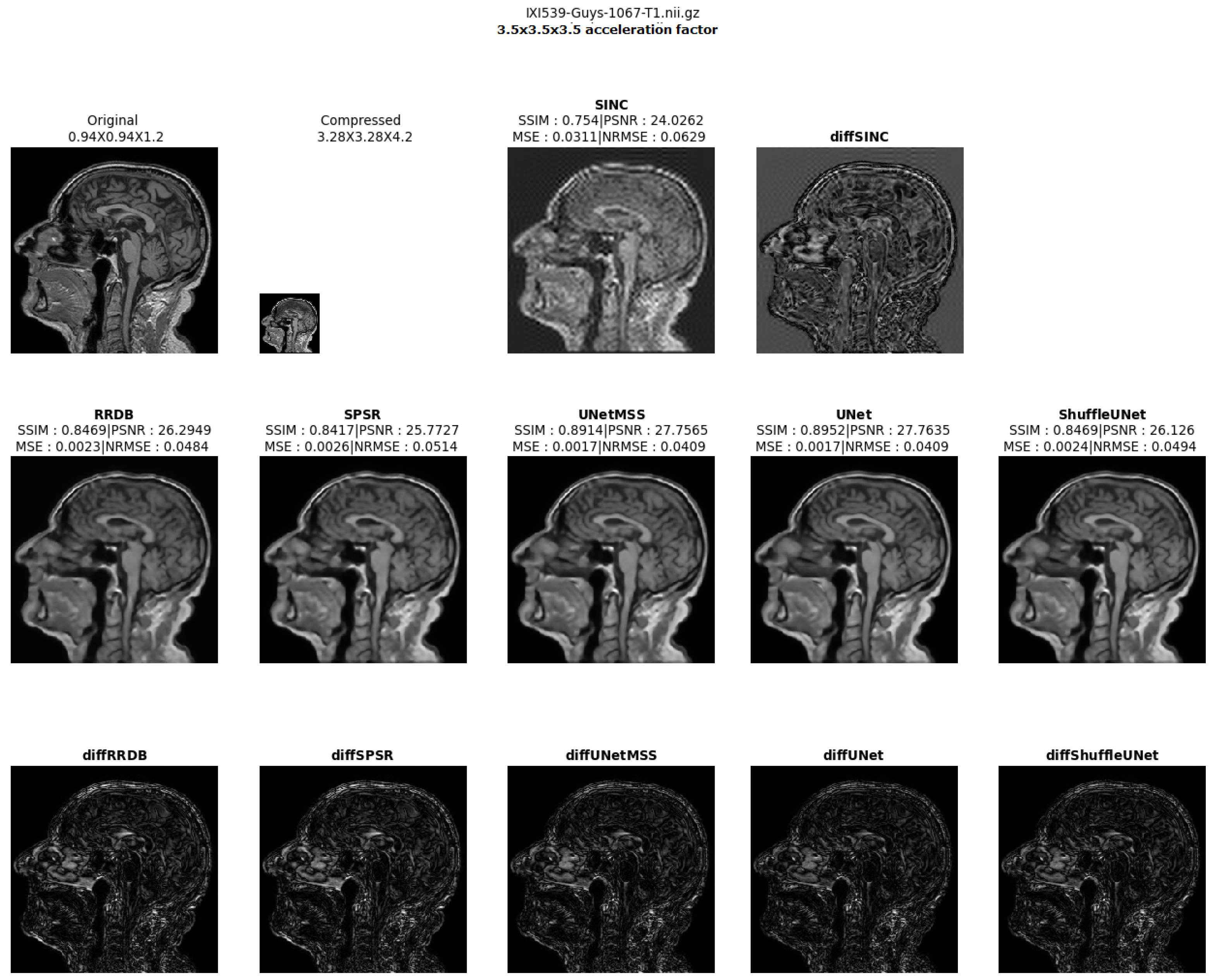 Jimaging 10 00207 g010