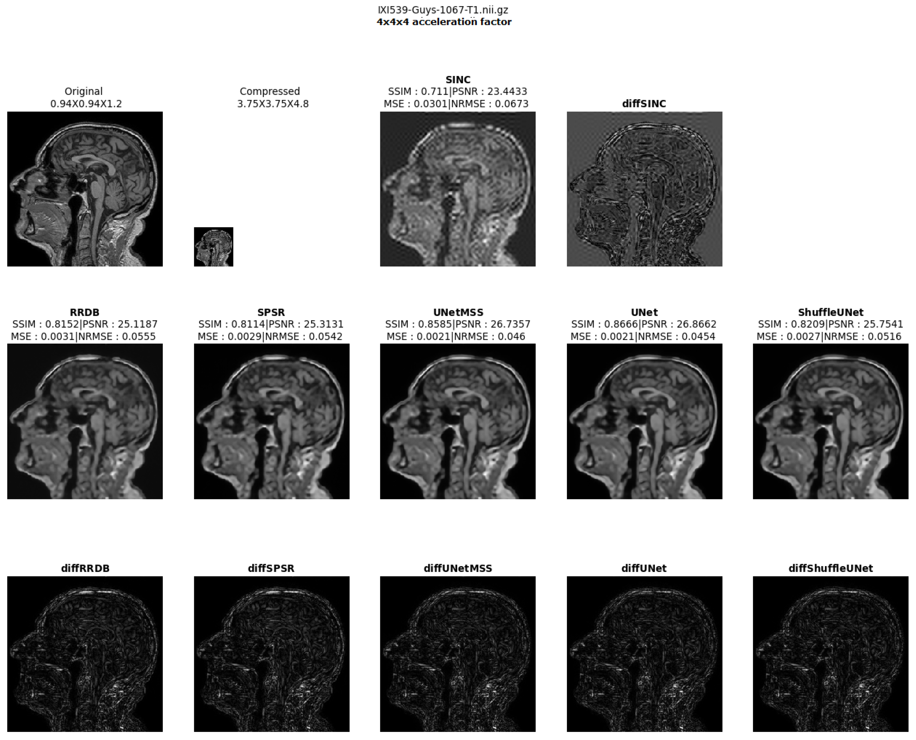 Jimaging 10 00207 g011