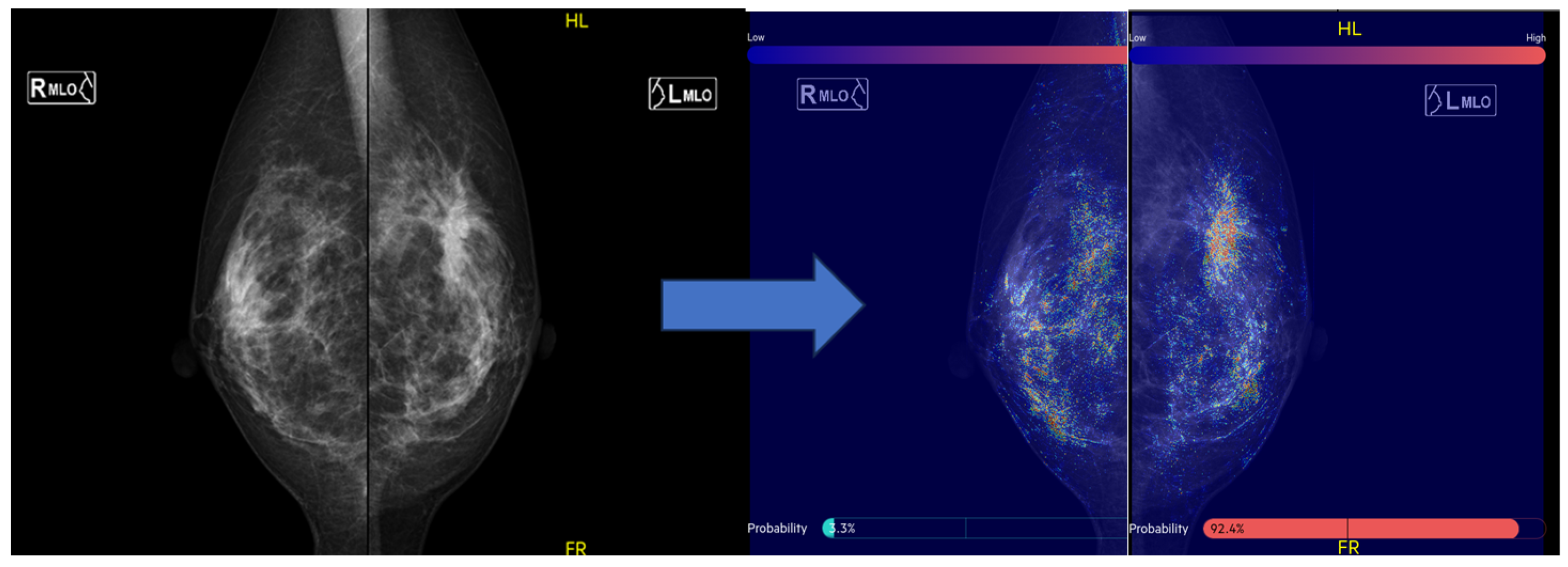 Jimaging 10 00211 g002 Jimaging 10 00211 g002