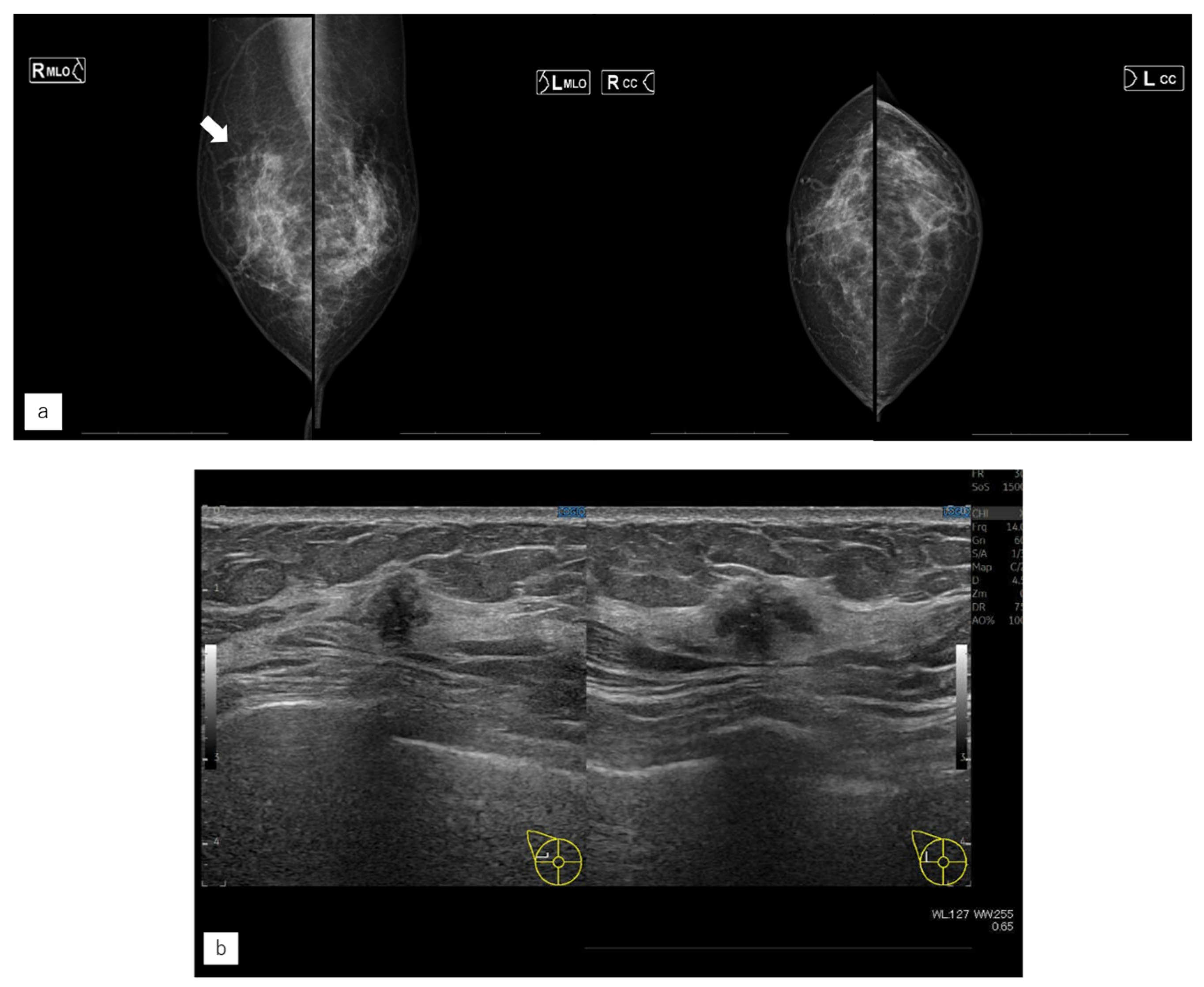 Jimaging 10 00211 g005a Jimaging 10 00211 g005a