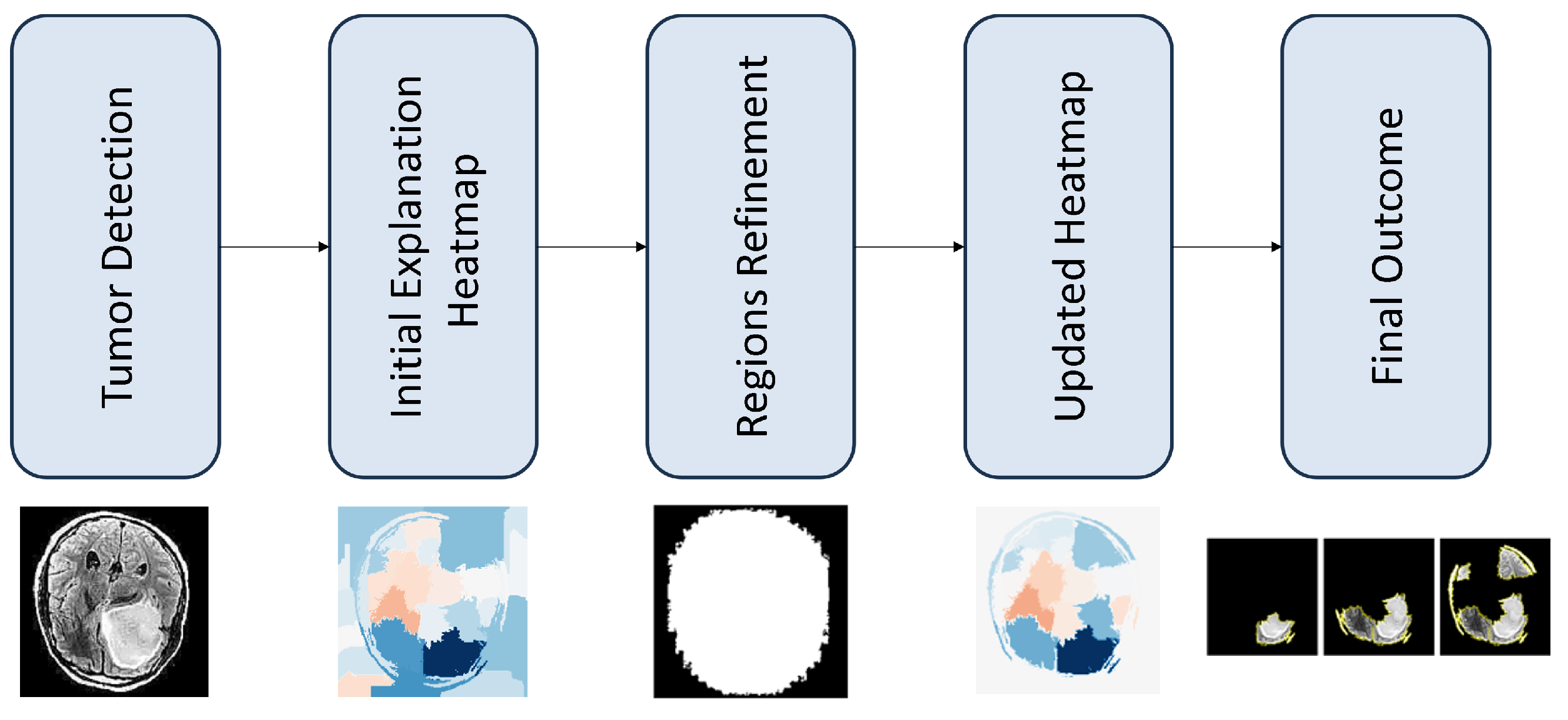 Enhancing Deep Learning Model Explainability in Brain Tumor Datasets ...