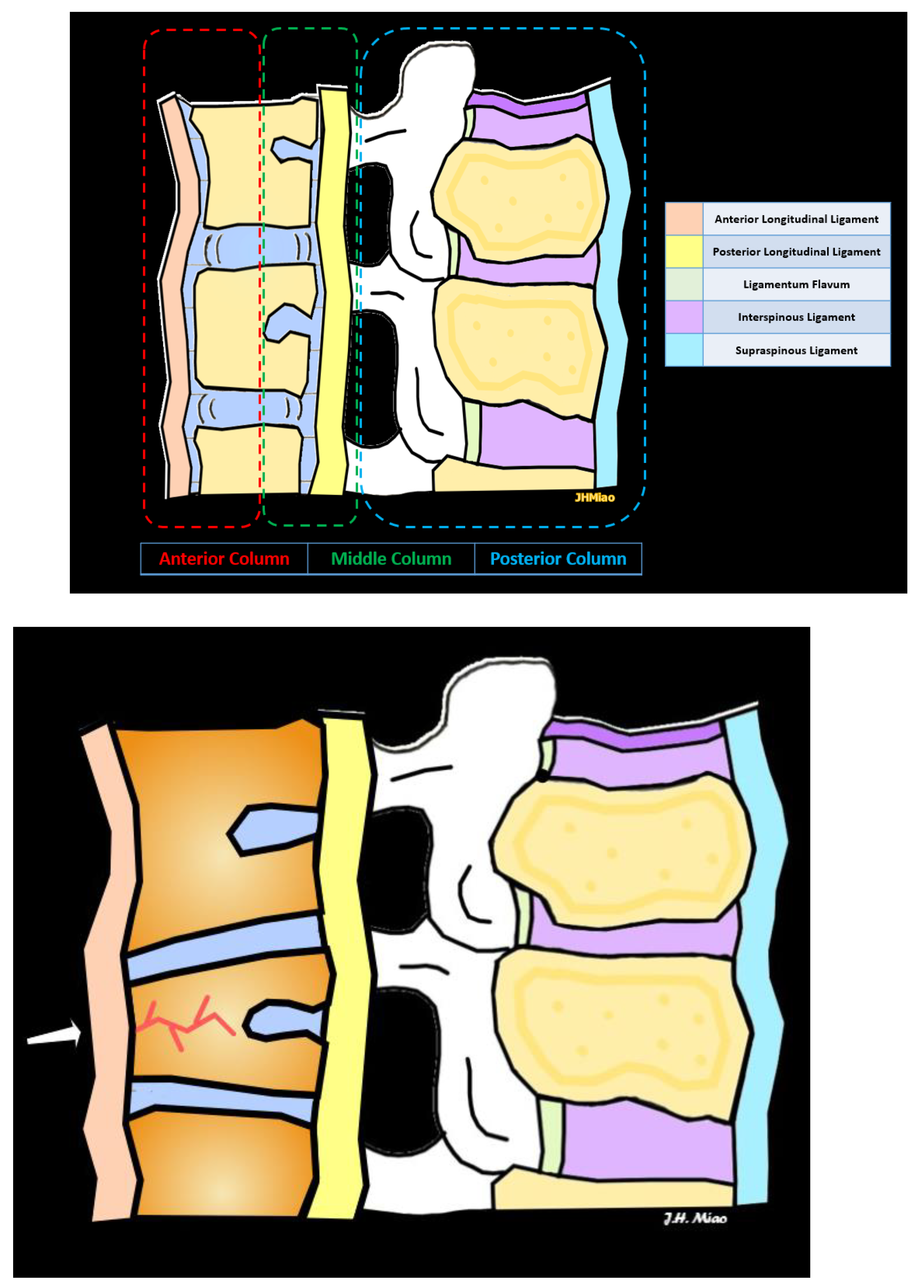 Radiological Diagnosis and Advances in Imaging of Vertebral