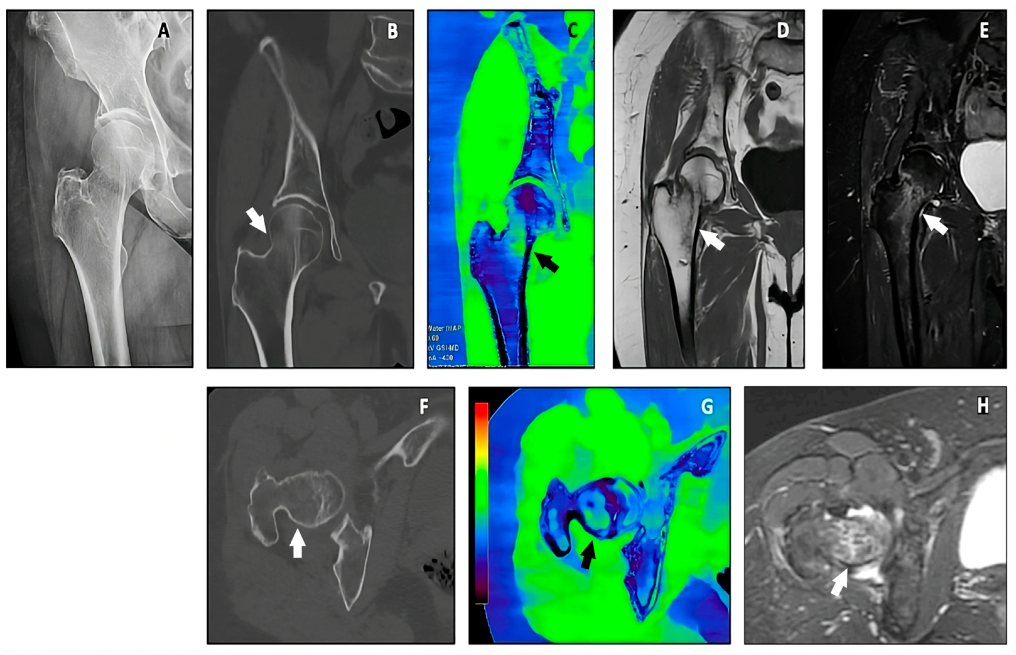 Jimaging 10 00267 g005