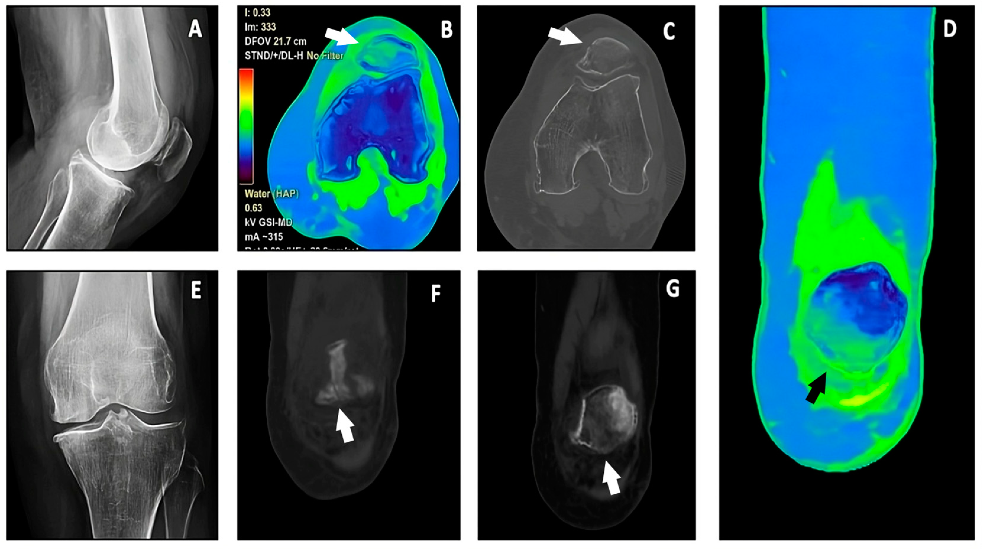 Jimaging 10 00267 g006