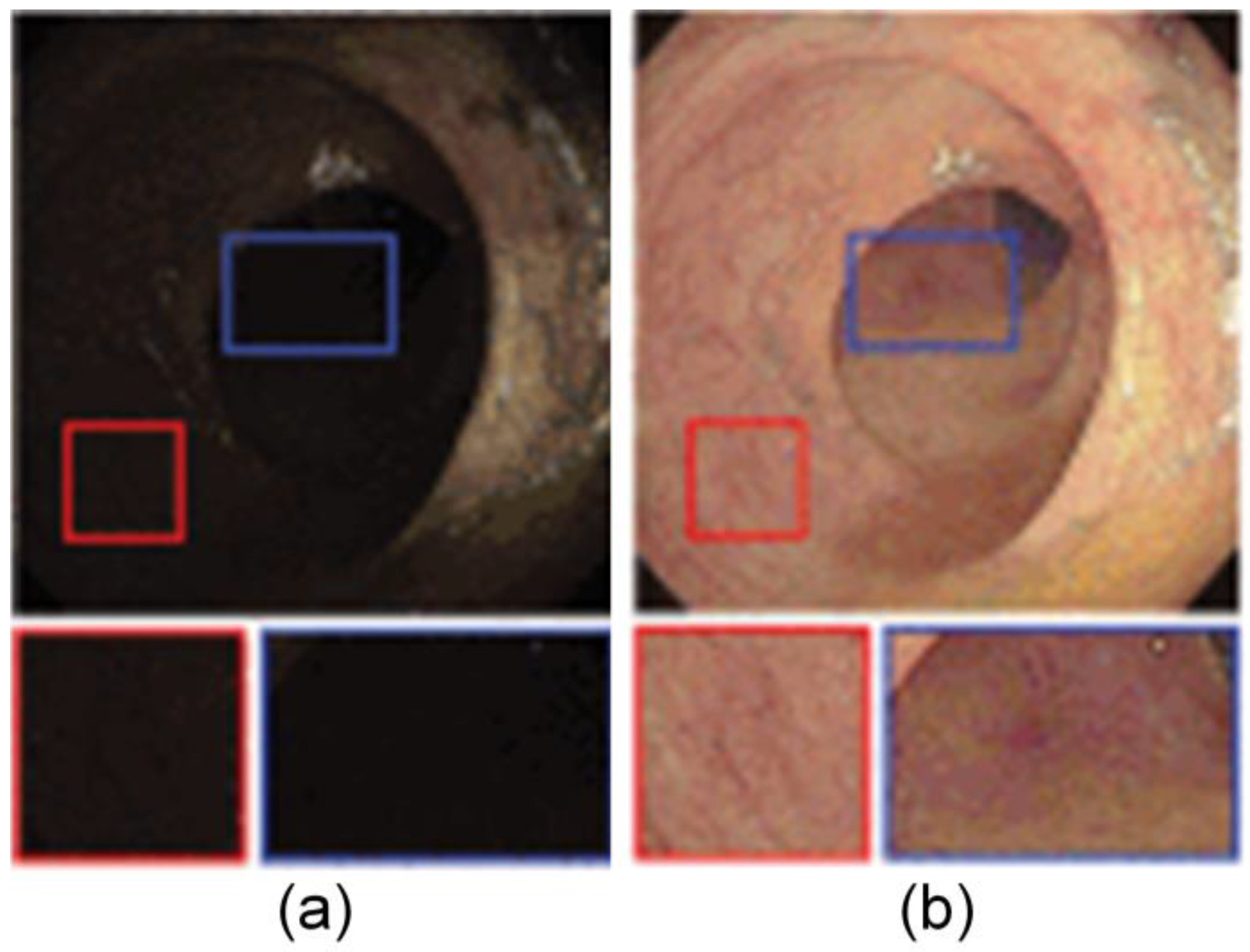 Jimaging 10 00275 g005