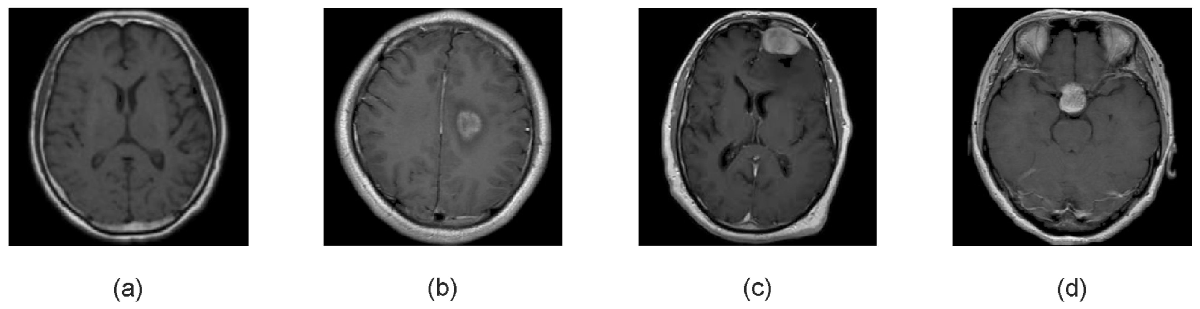 Jimaging 11 00002 g005