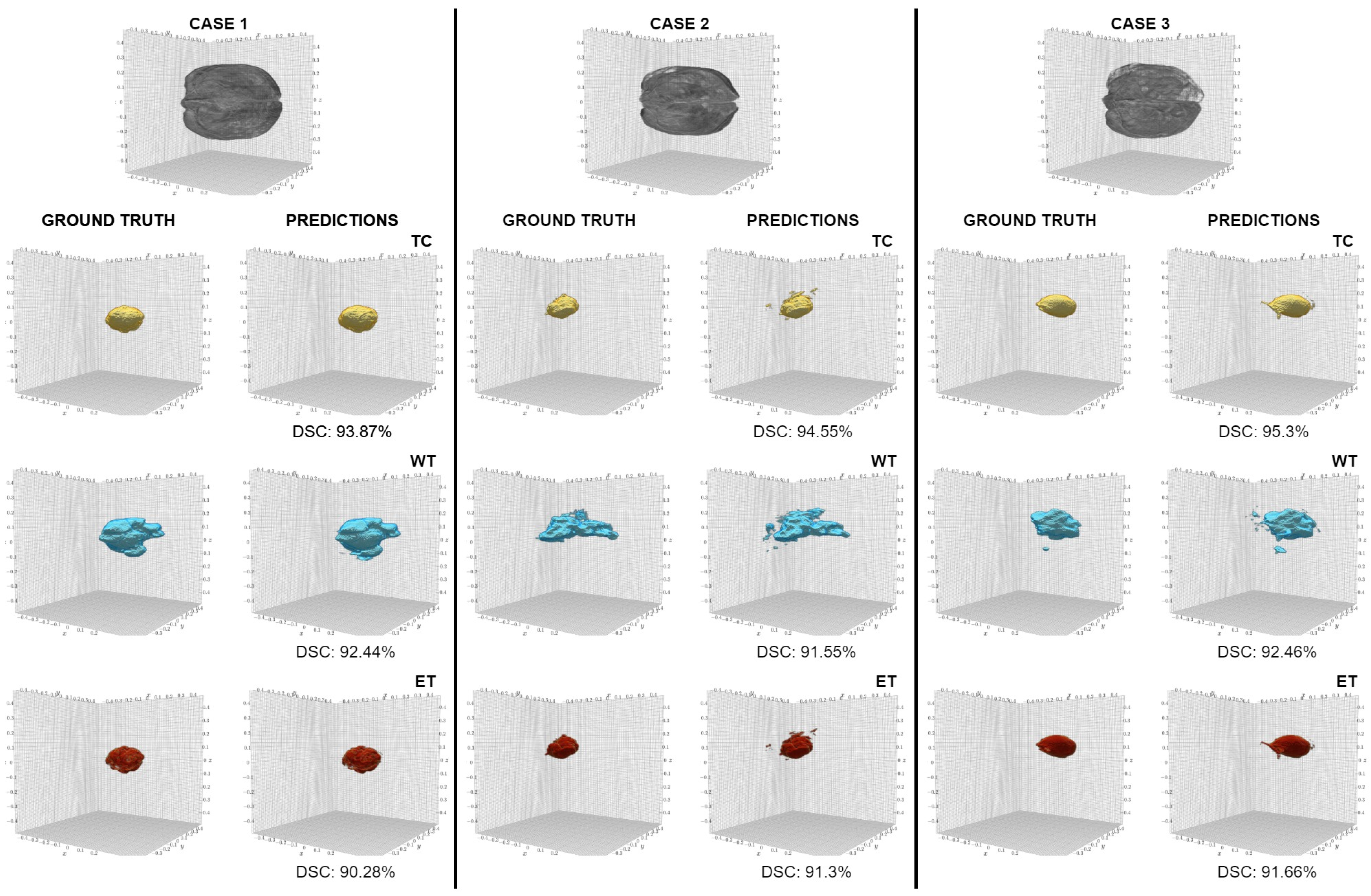 Jimaging 11 00008 g006
