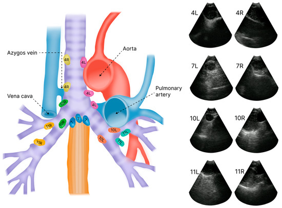 A New Deep Learning-Based Method for Automated Identification of ...