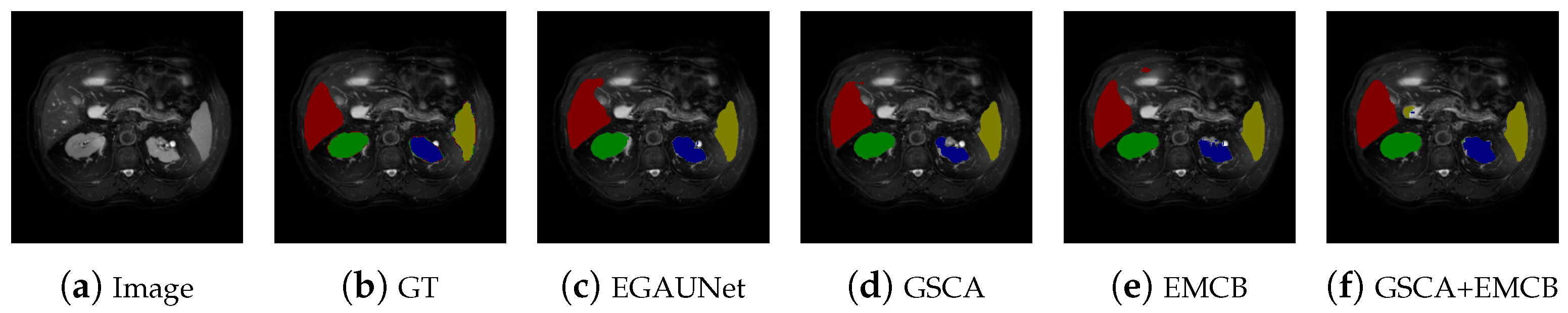 Jimaging 11 00019 g011