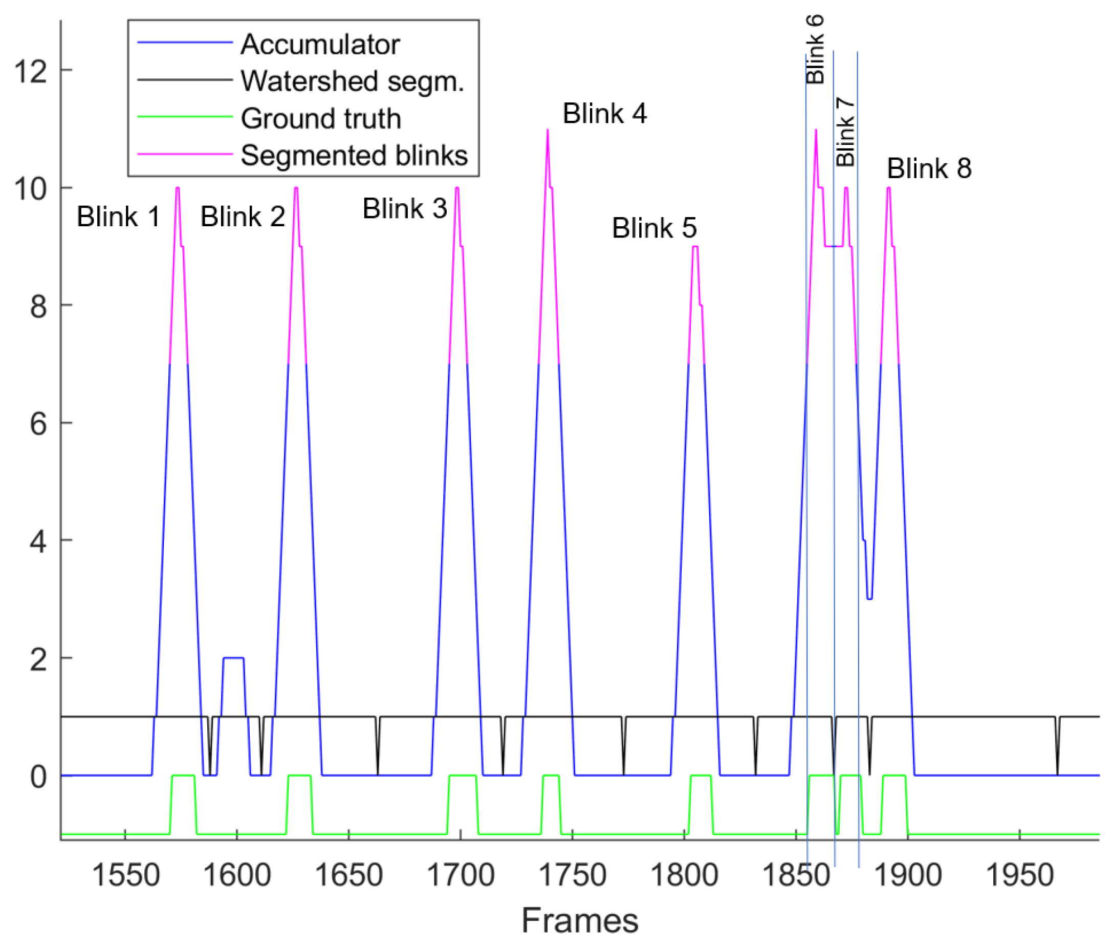Jimaging 11 00027 g004