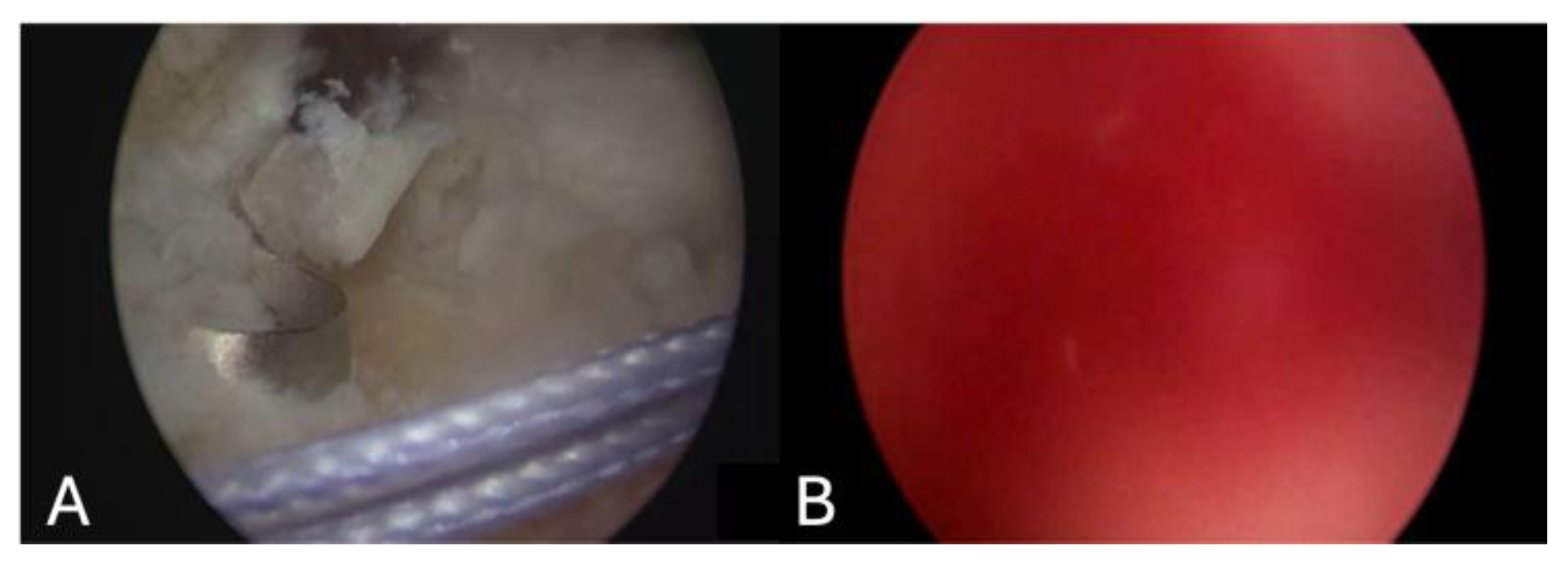 Jimaging 11 00040 g003