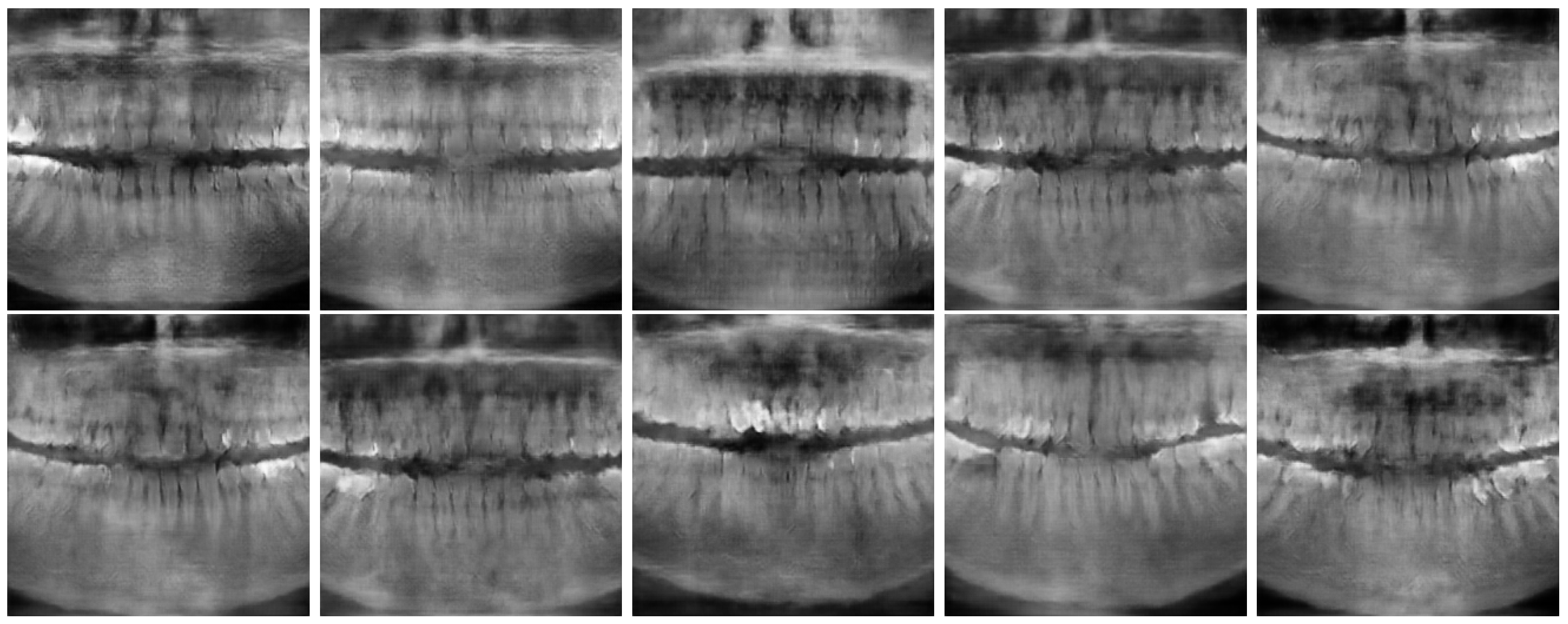 Jimaging 11 00041 g006