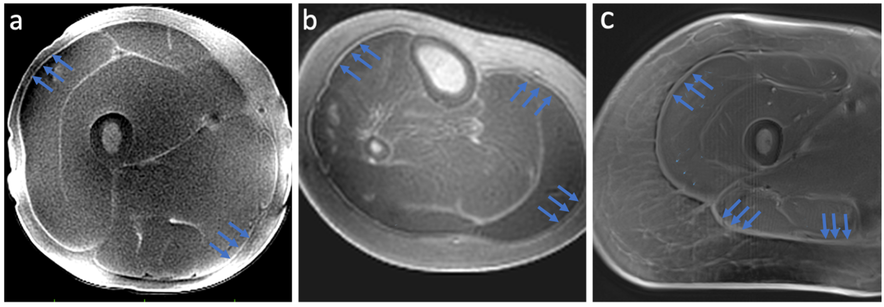 Jimaging 11 00043 g003