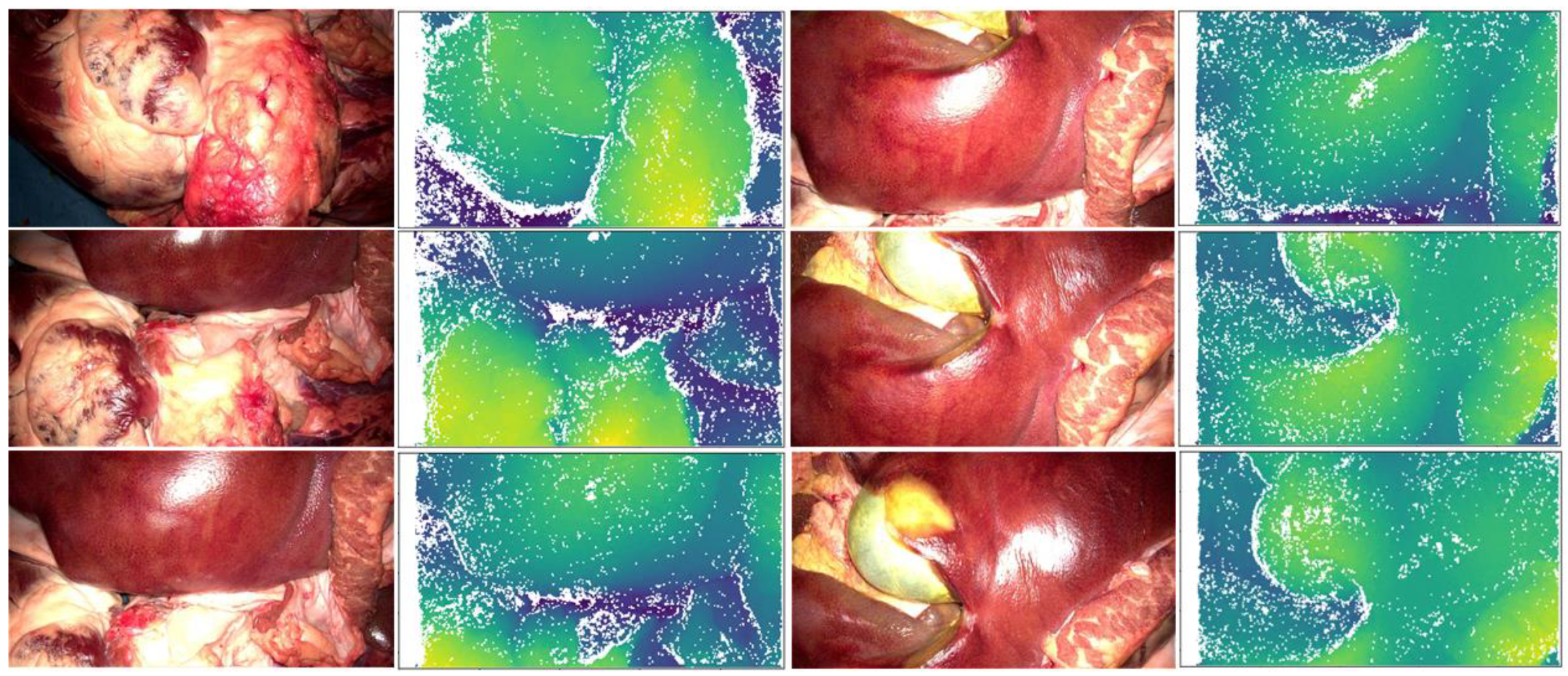 Jimaging 11 00044 g006