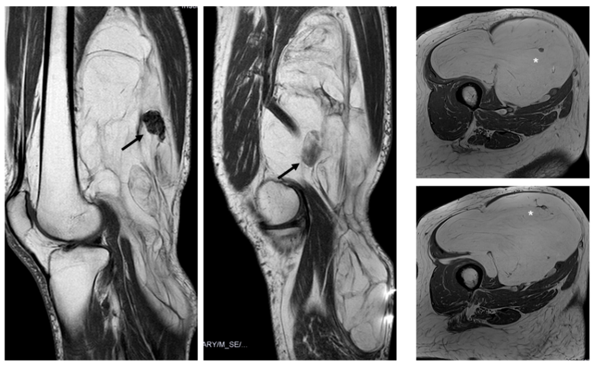 Jimaging 11 00047 g006