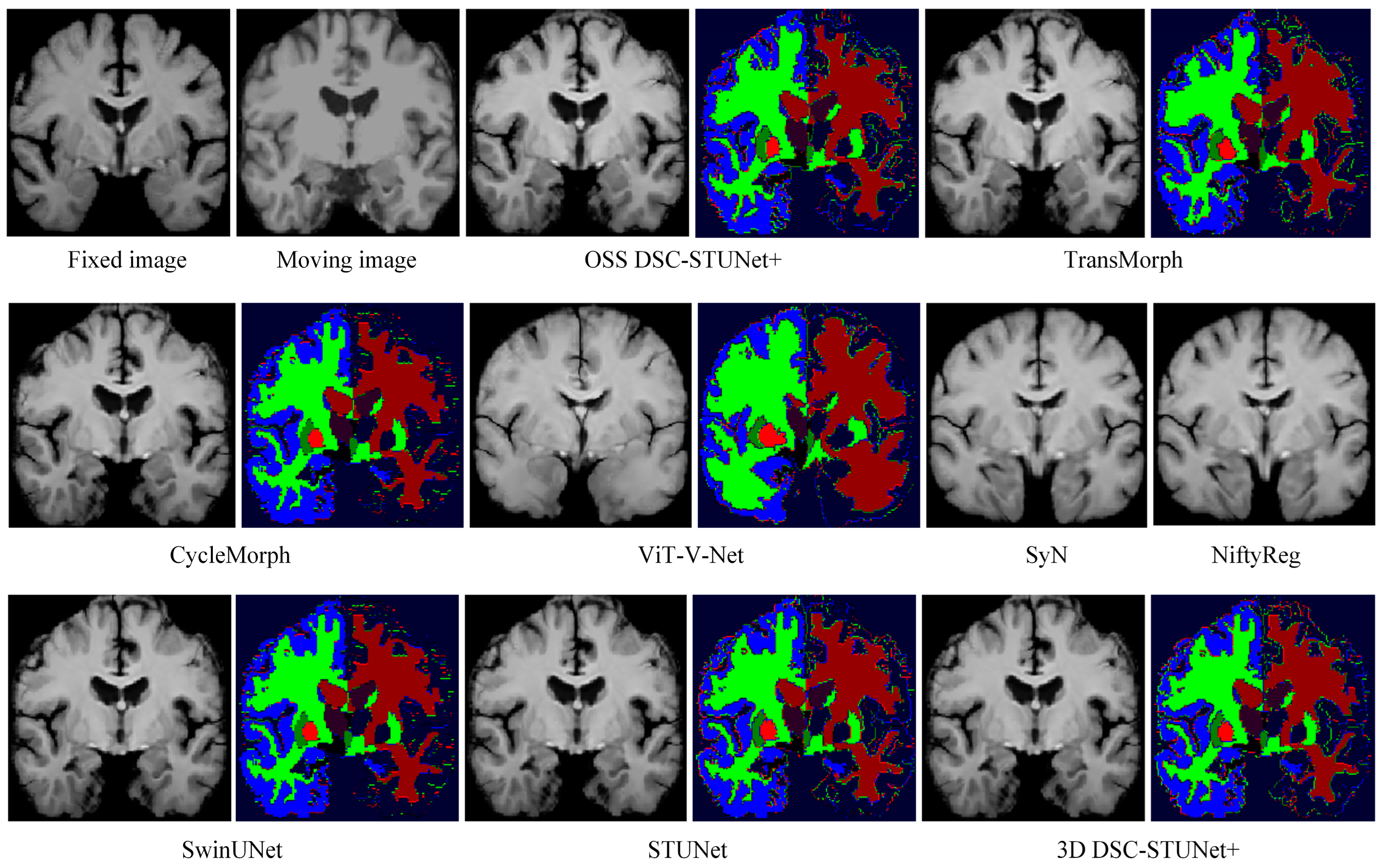 Jimaging 11 00054 g007