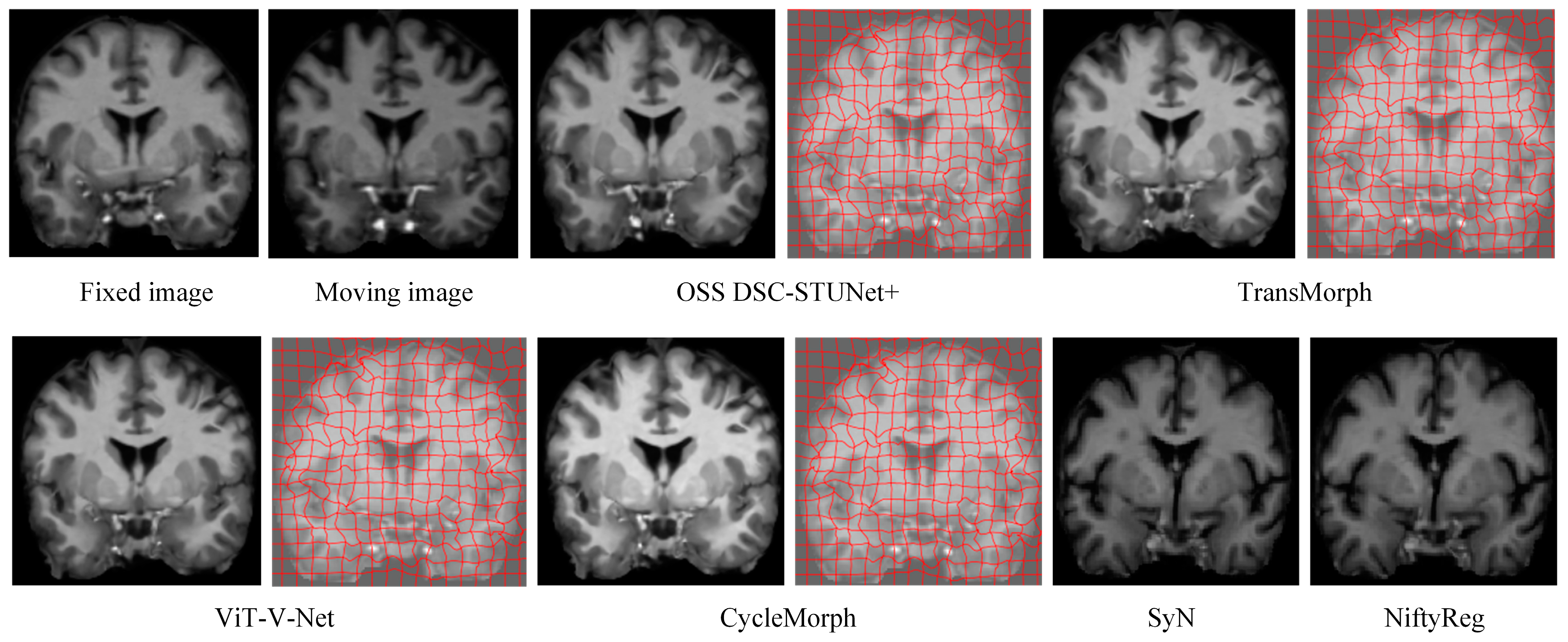 Jimaging 11 00054 g008