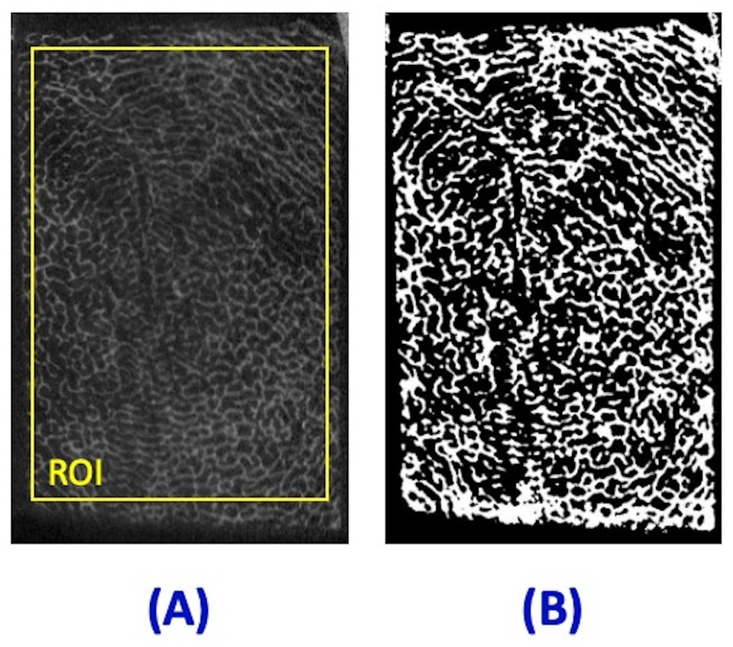 Jimaging 11 00057 g002 Jimaging 11 00057 g002