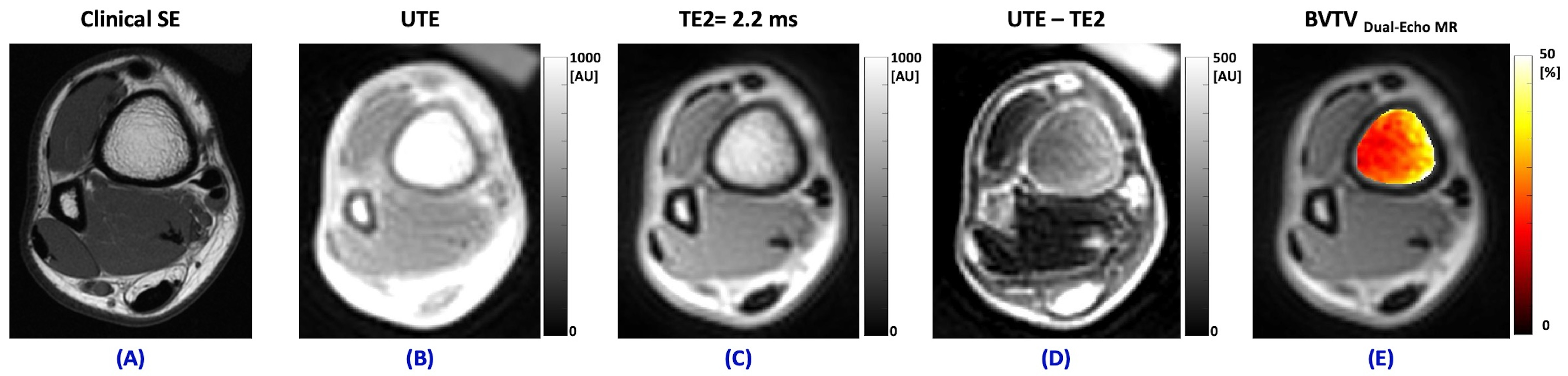 Jimaging 11 00057 g005 Jimaging 11 00057 g005
