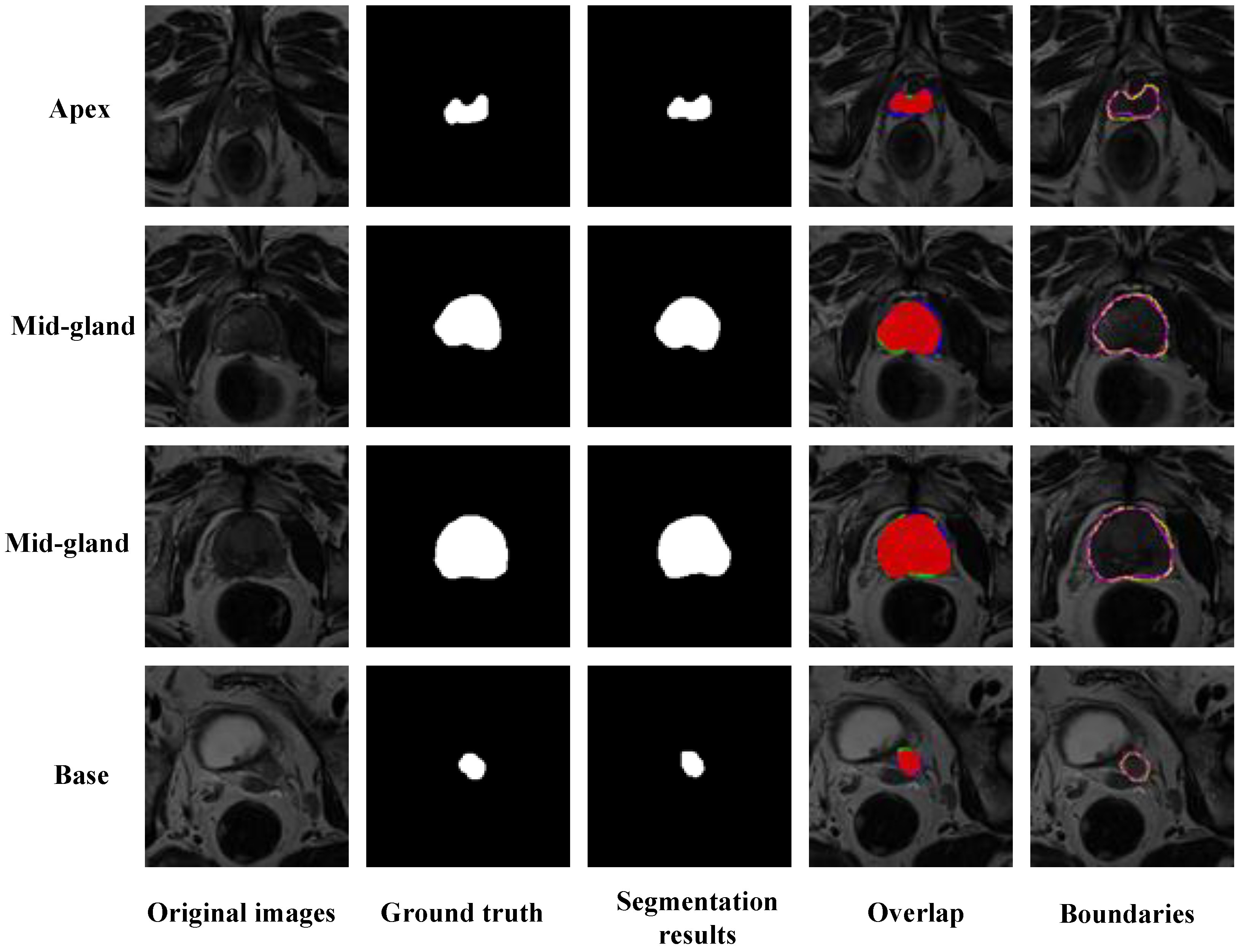 Jimaging 11 00061 g005