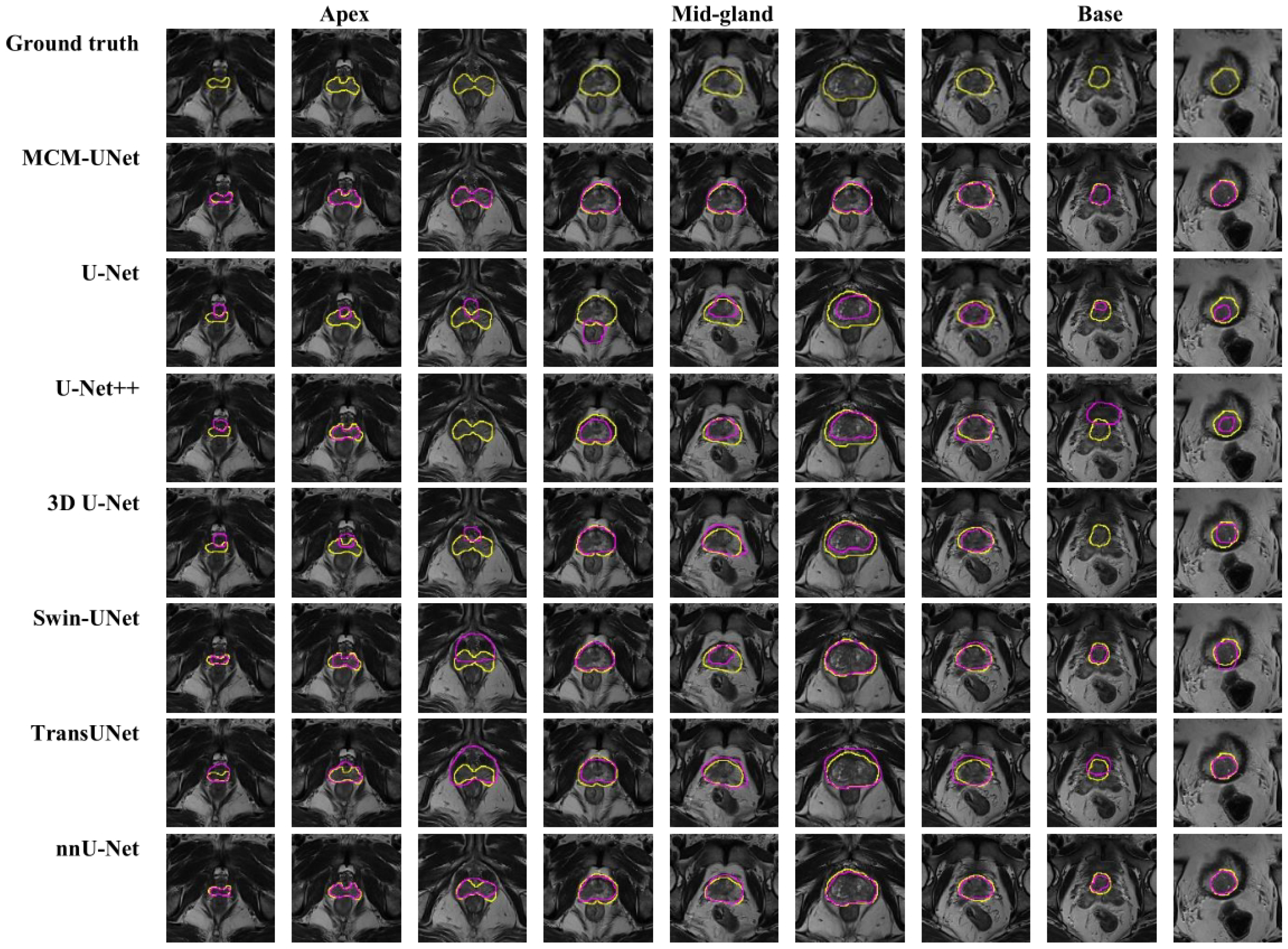 Jimaging 11 00061 g007