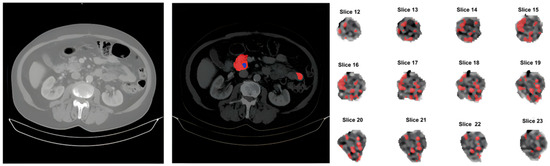 T-Cell Manipulation Strategies to Prevent Graft-Versus-Host