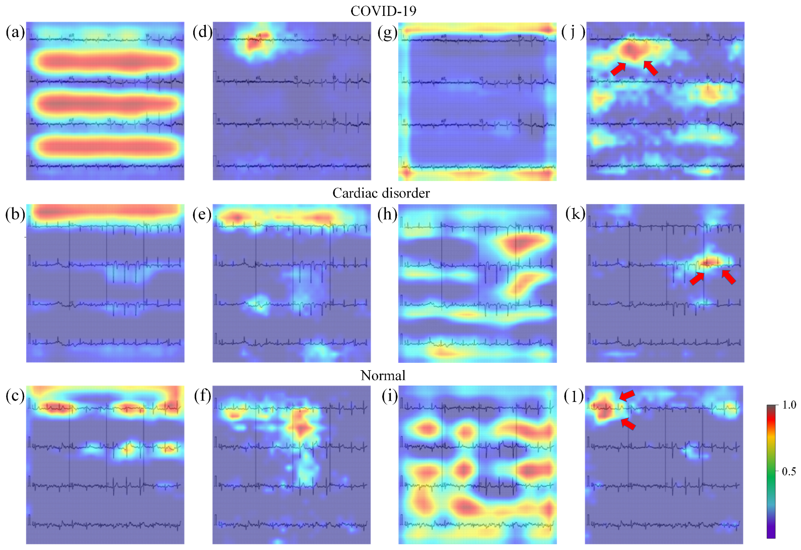 Jimaging 11 00076 g005