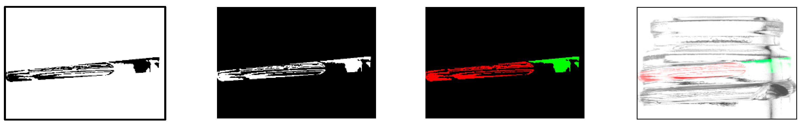 Jimaging 11 00077 g006