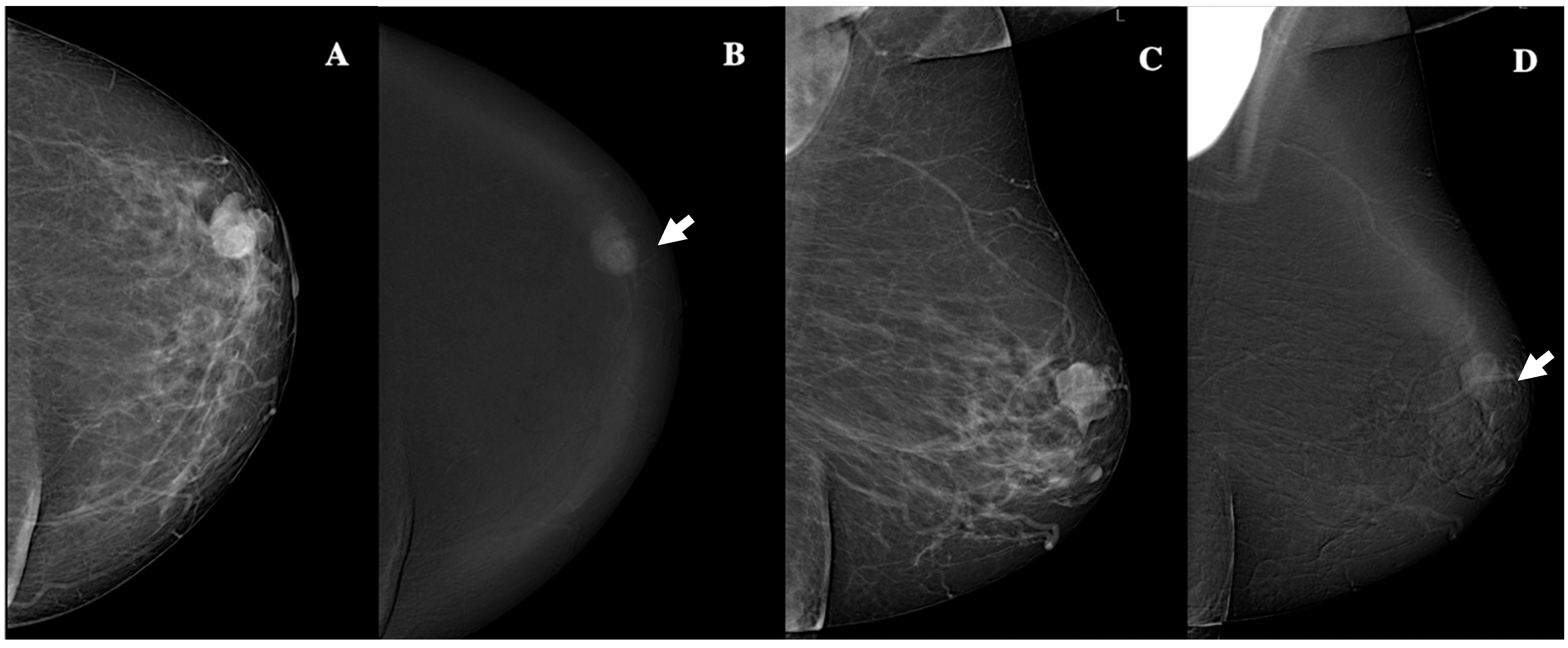 Jimaging 11 00080 g003