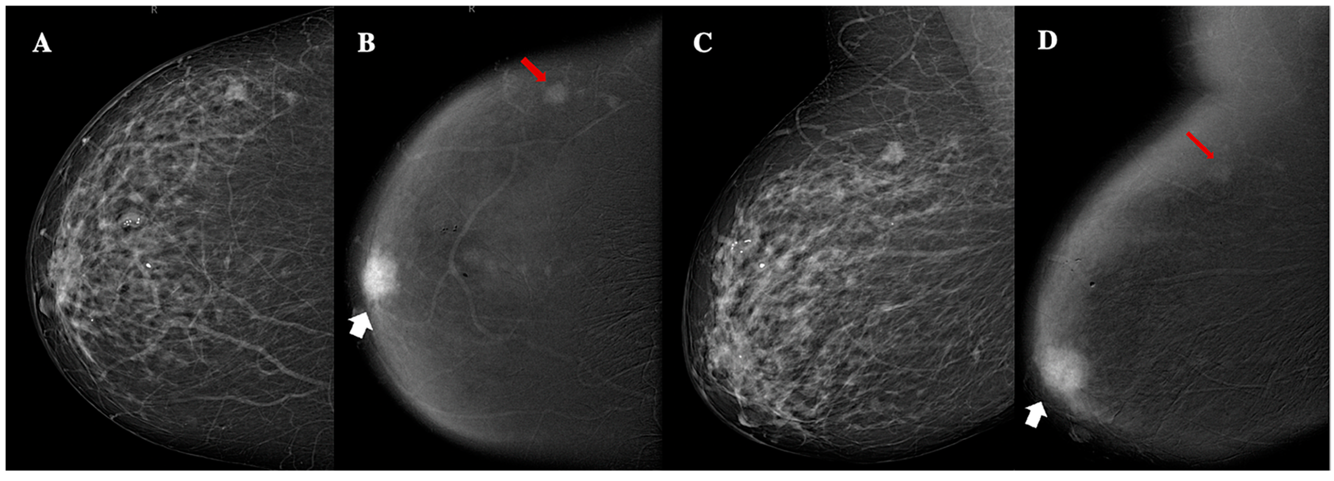 Jimaging 11 00080 g004
