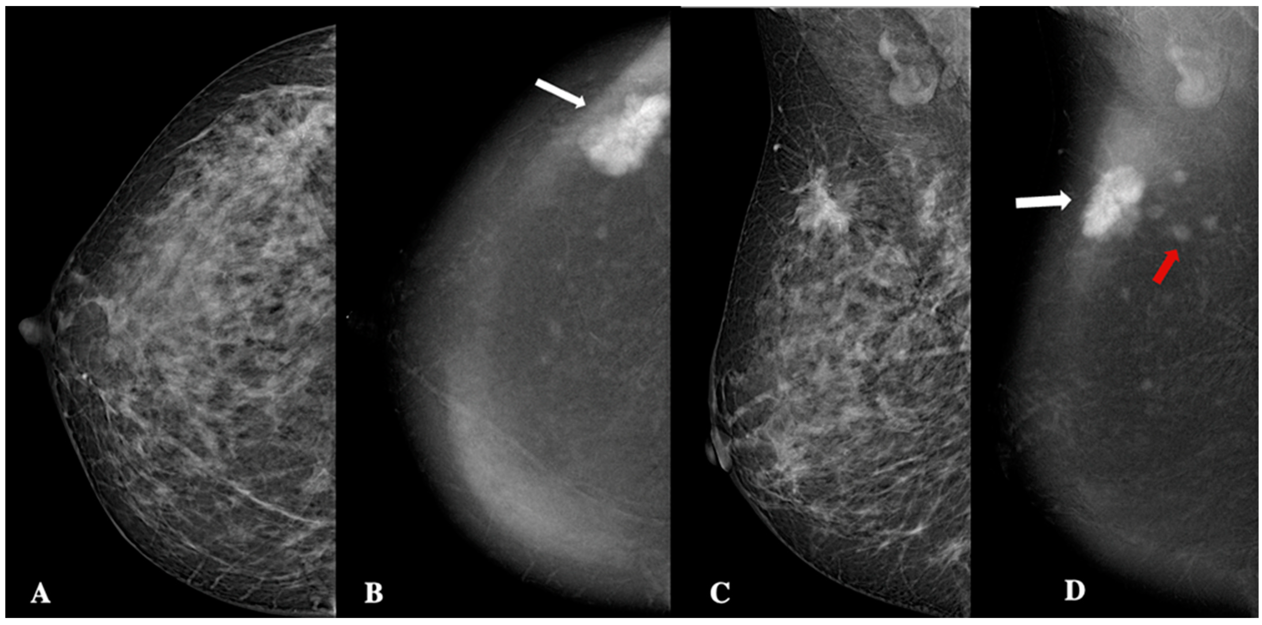 Jimaging 11 00080 g005