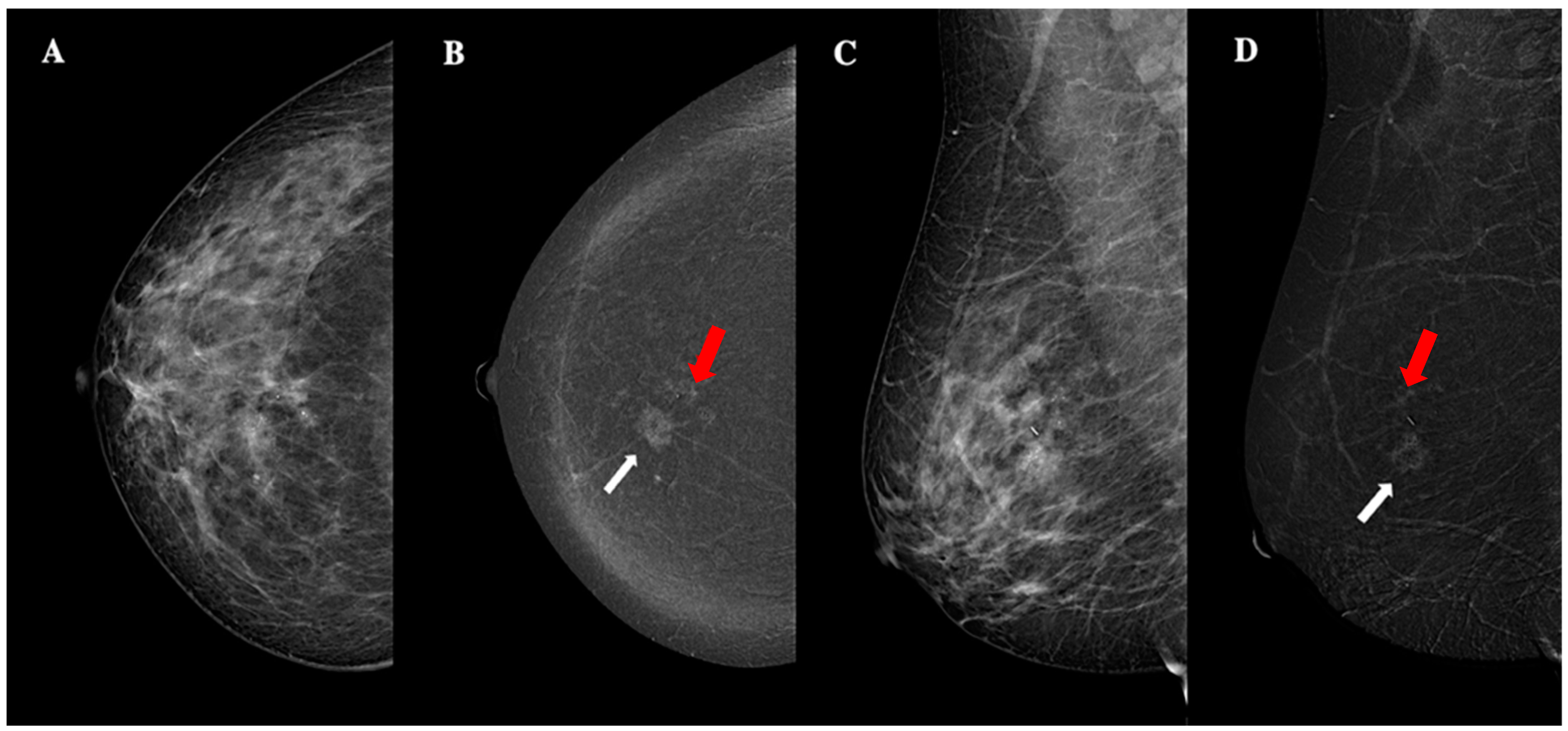 Jimaging 11 00080 g006